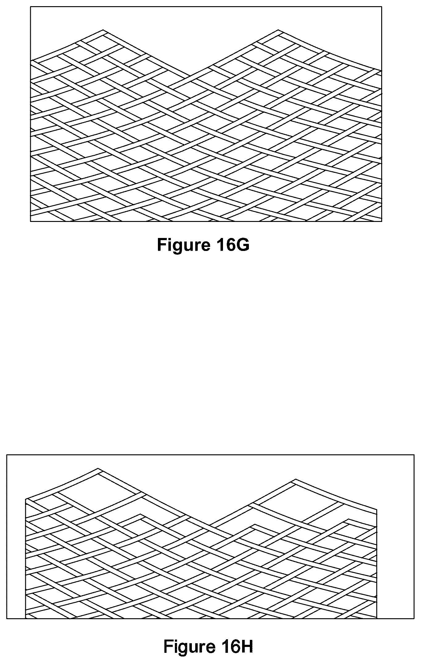 Patent US12551357 Figure 16 – Stent