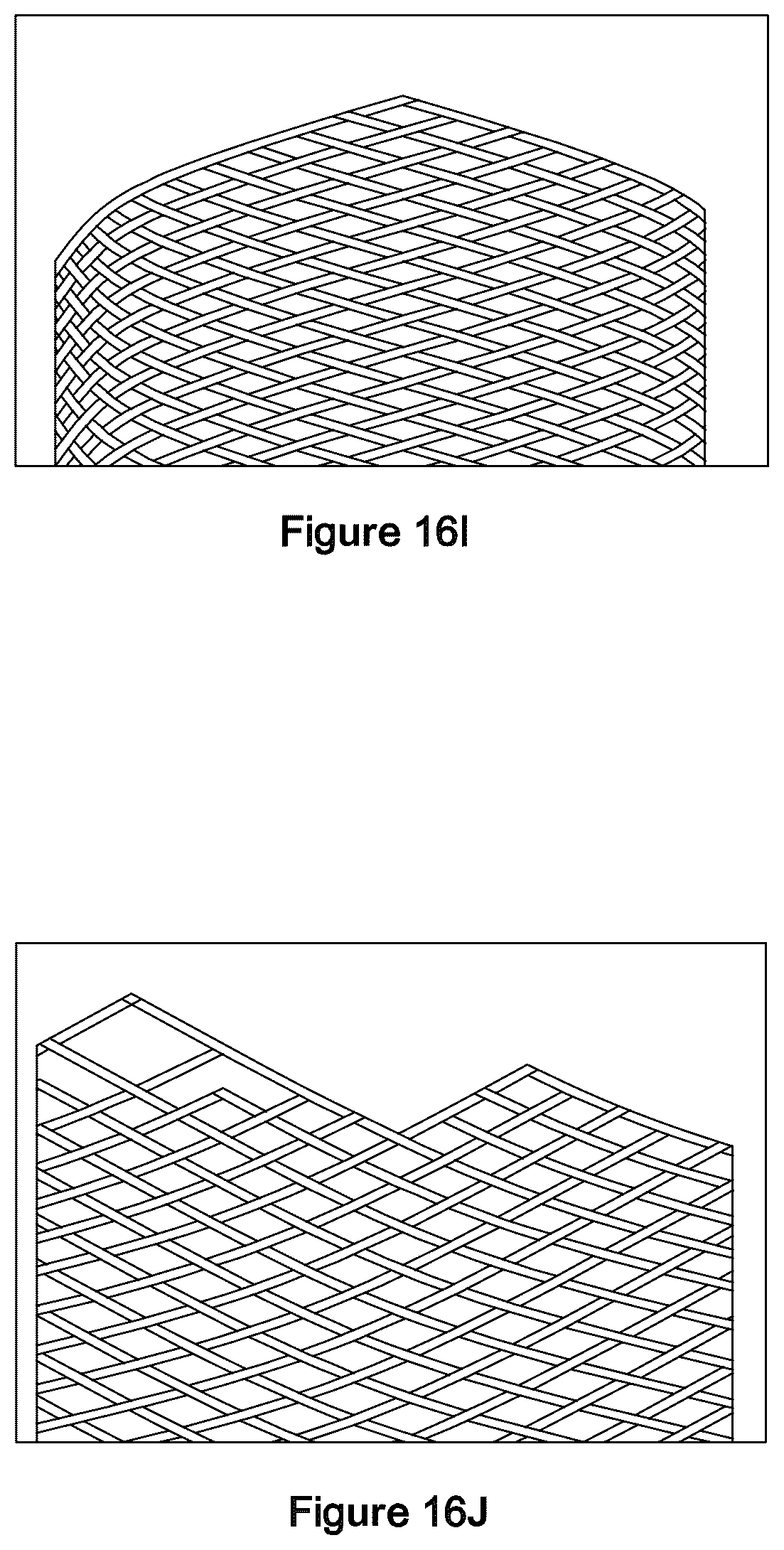 Patent US12551357 Figure 17 – Stent