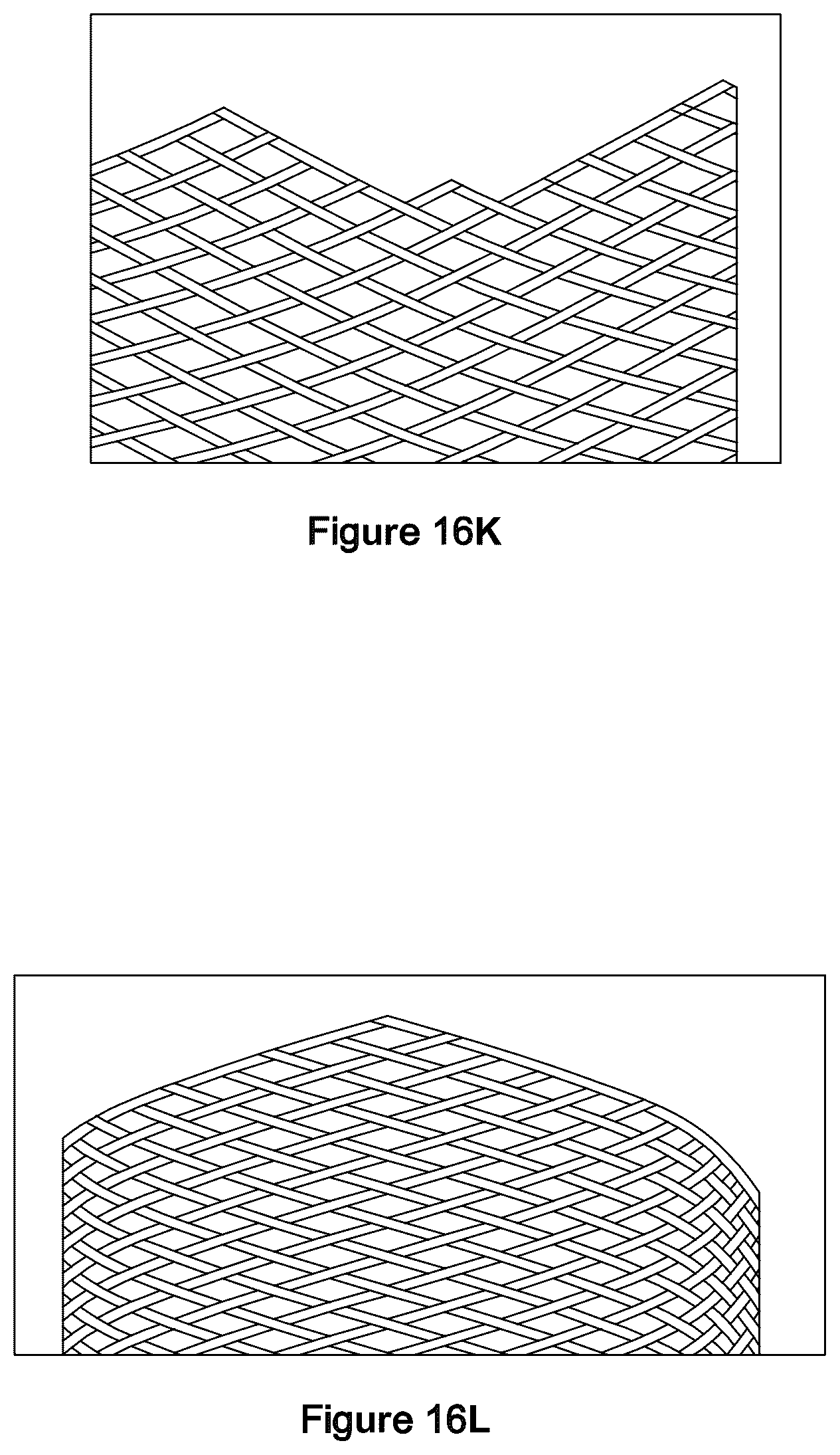 Patent US12551357 Figure 18 – Stent