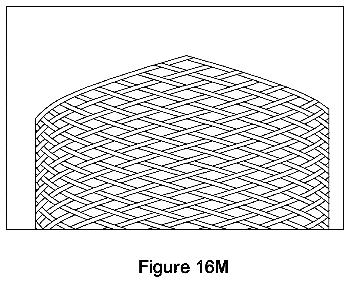 Patent US12551357 Figure 19 – Stent