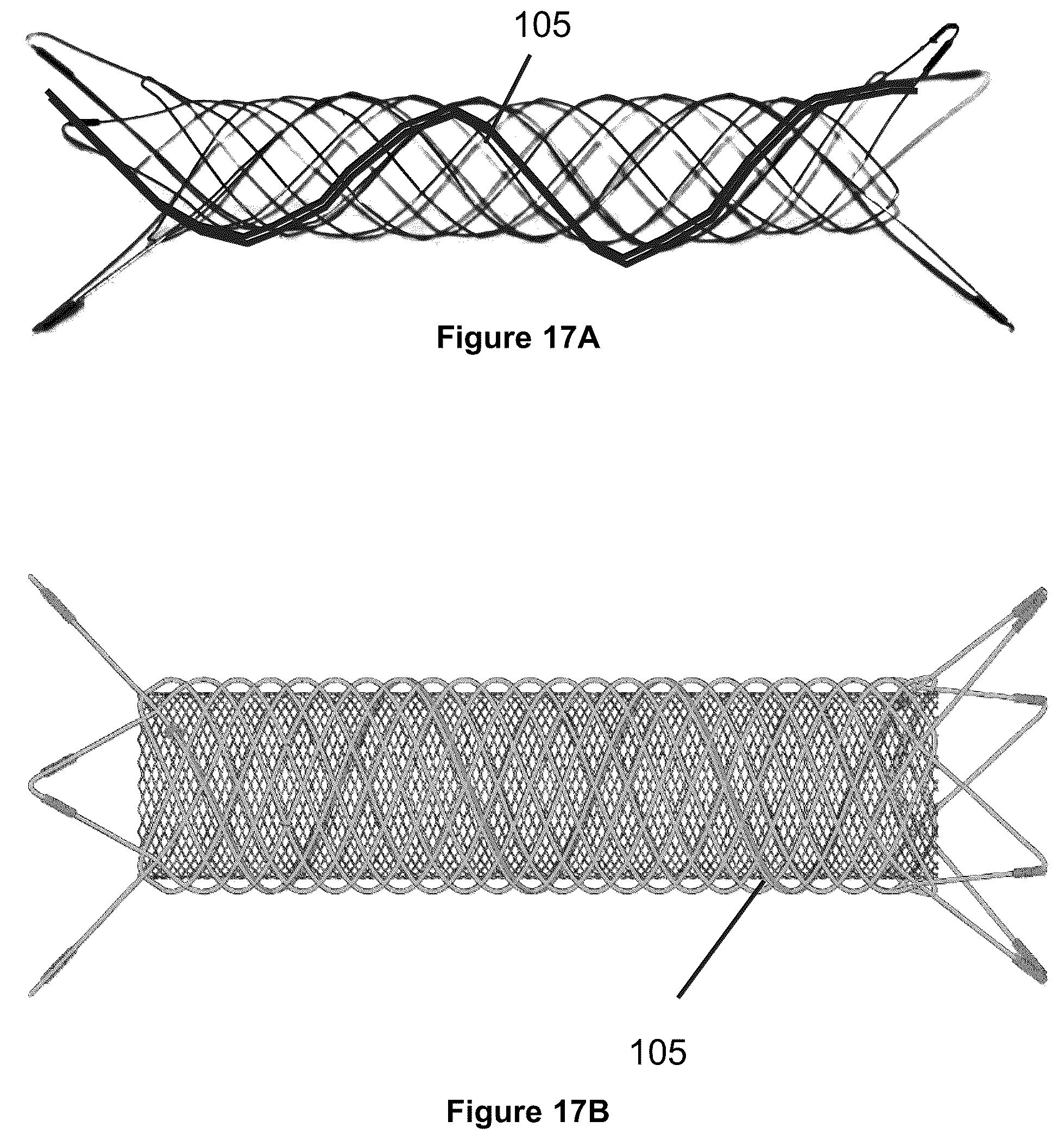 Patent US12551357 Figure 20 – Stent