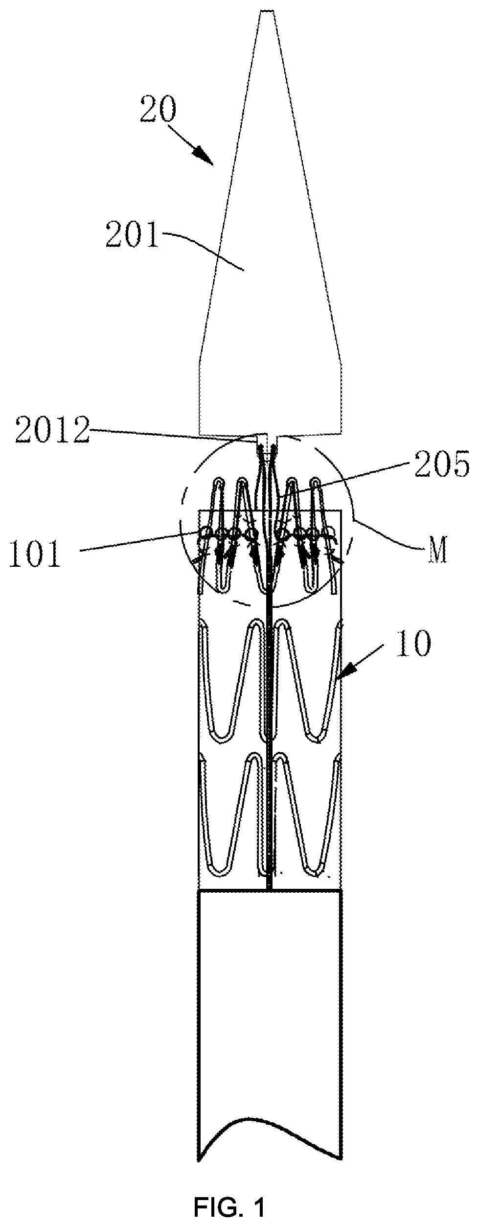 Patent US12551358 Figure 1 – Stent delivery and release device and stent delivery and release system