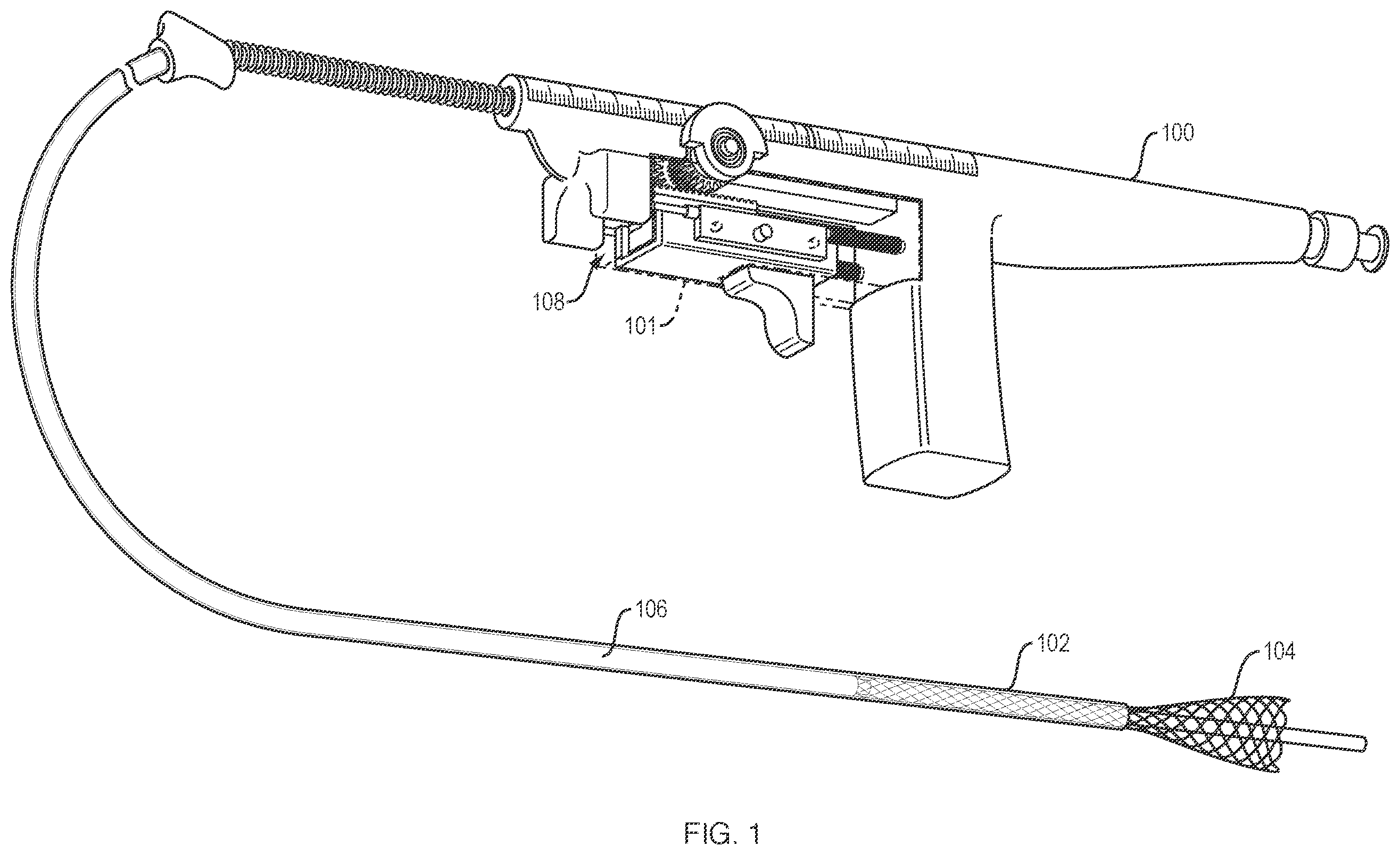 Patent US12551359 — Devices and methods for controlled delivery of a stent — Figure 1