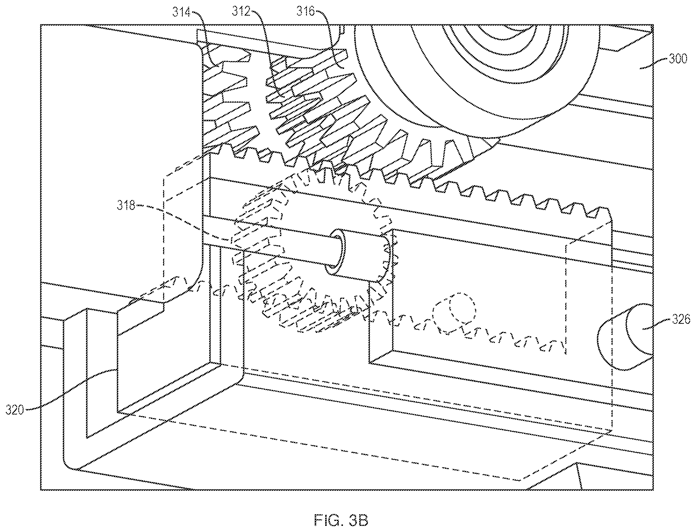 Patent US12551359 Figure 4 – Devices and methods for controlled delivery of a stent