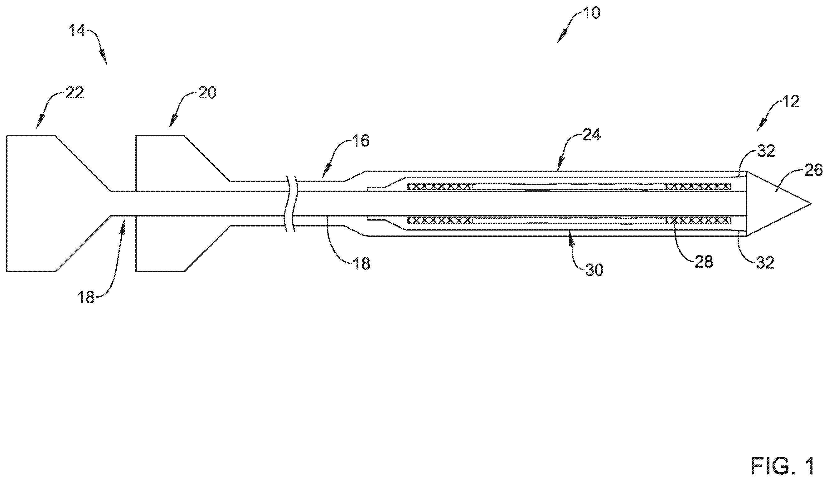 Patent US12551360 — Stent delivery system — Figure 1