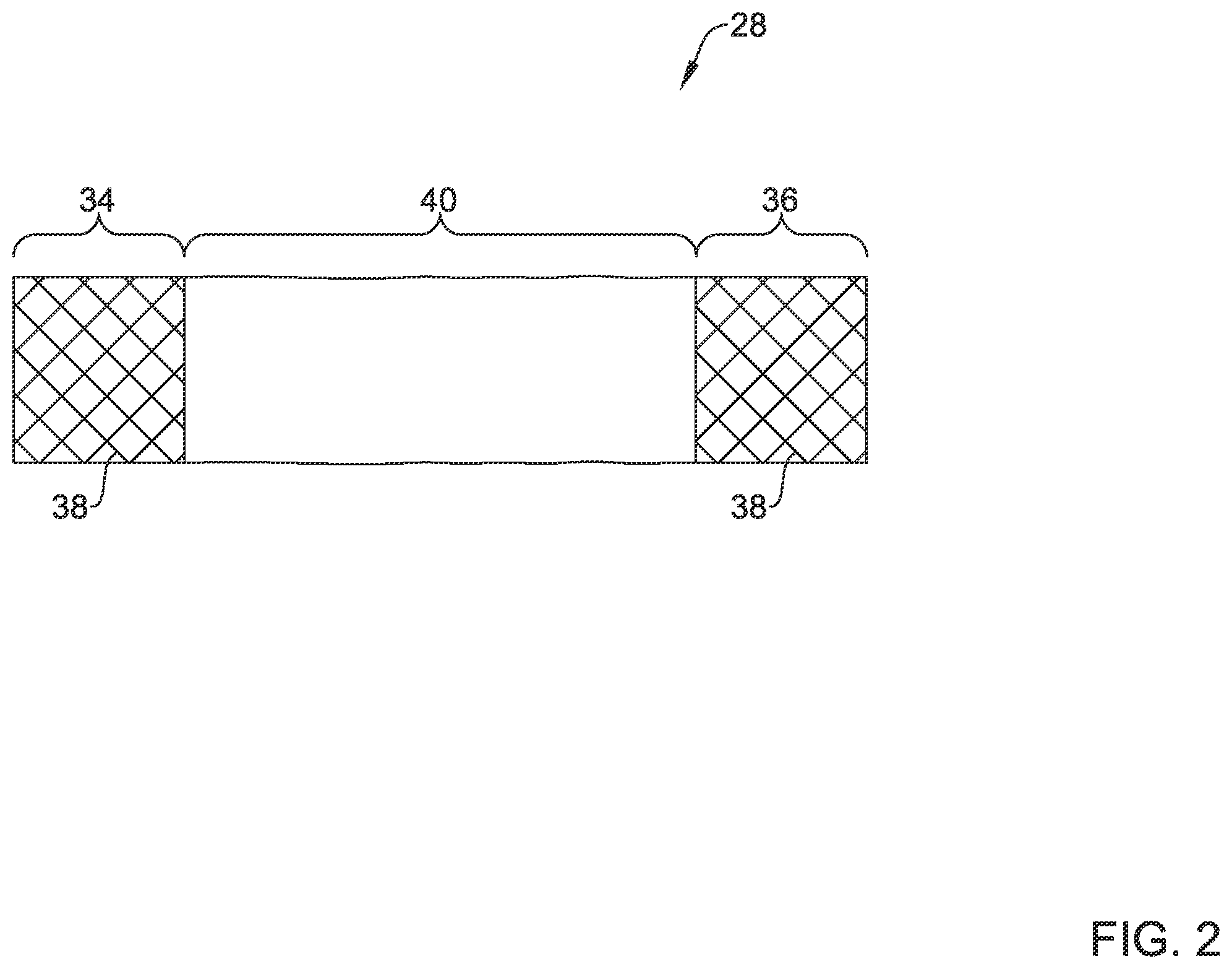 Patent US12551360 Figure 2 – Stent delivery system