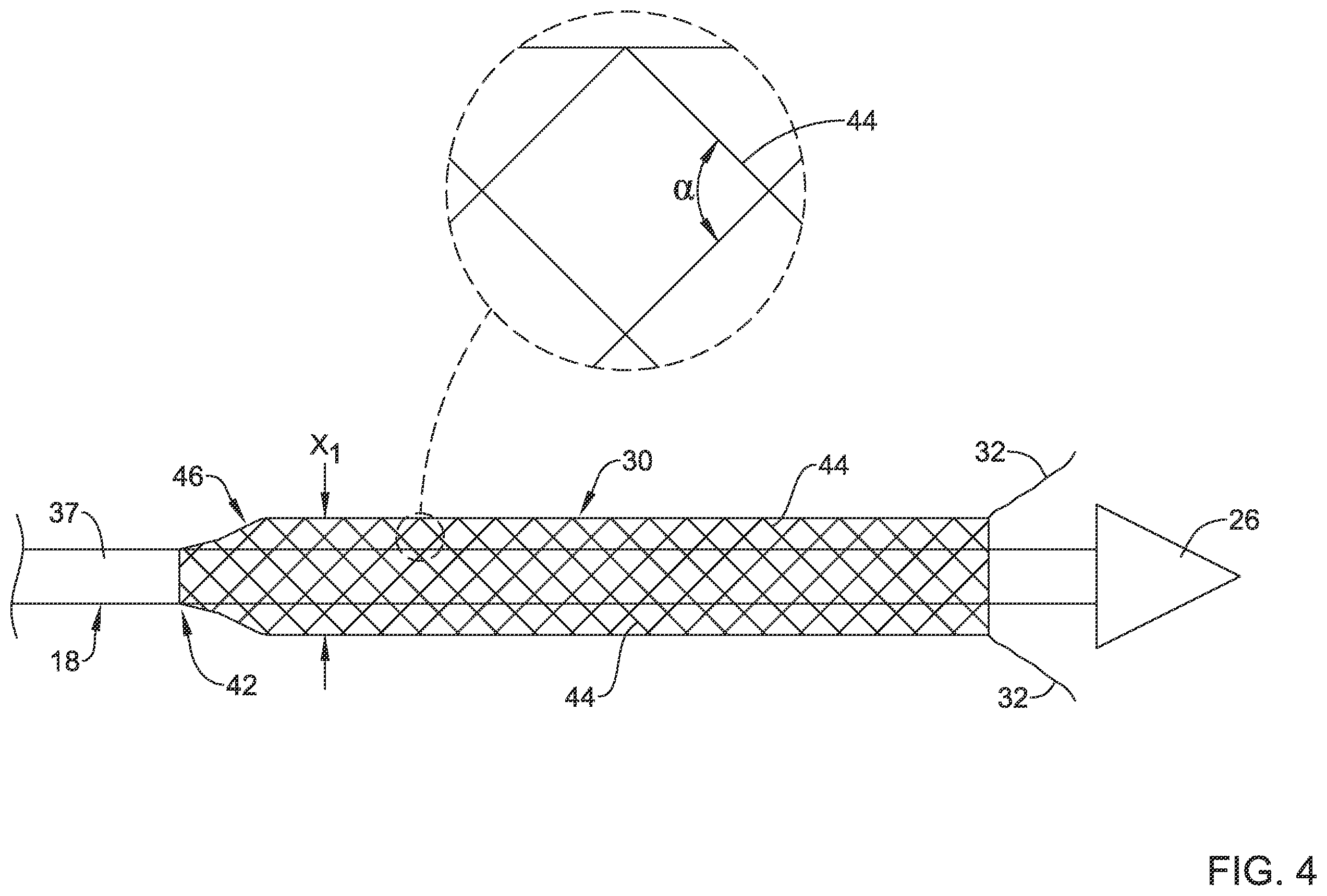 Patent US12551360 Figure 4 – Stent delivery system