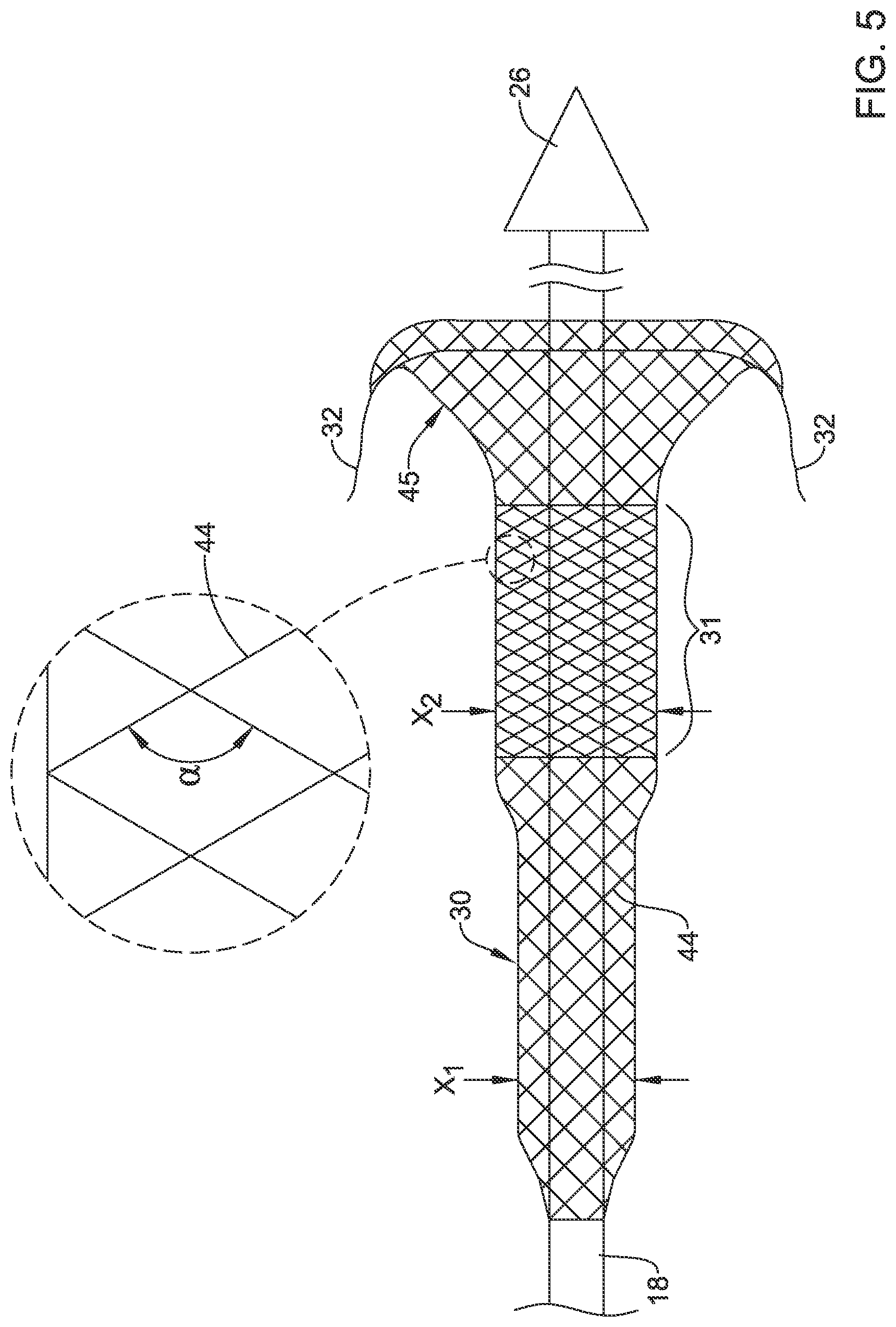 Patent US12551360 Figure 5 – Stent delivery system