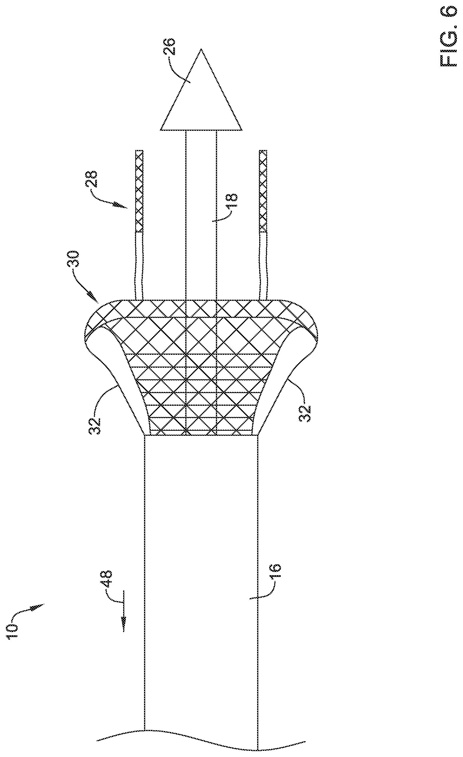 Patent US12551360 Figure 6 – Stent delivery system