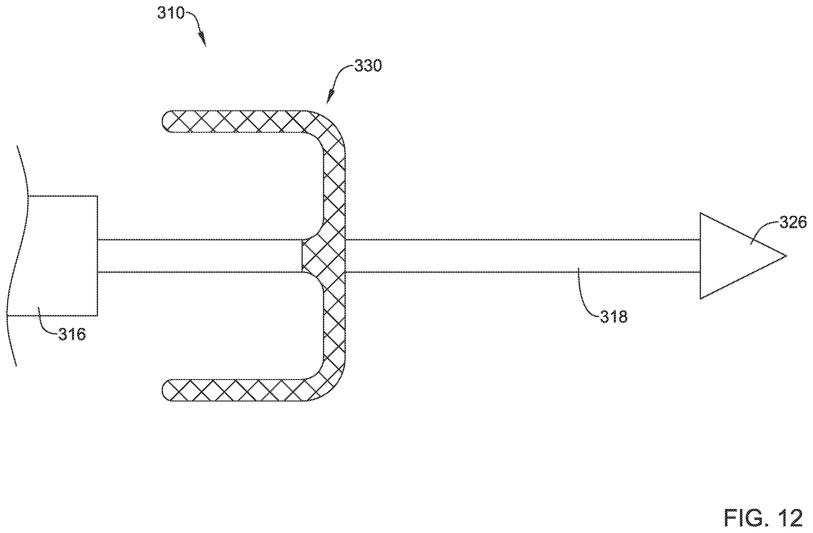 Patent US12551360 Figure 12 – Stent delivery system