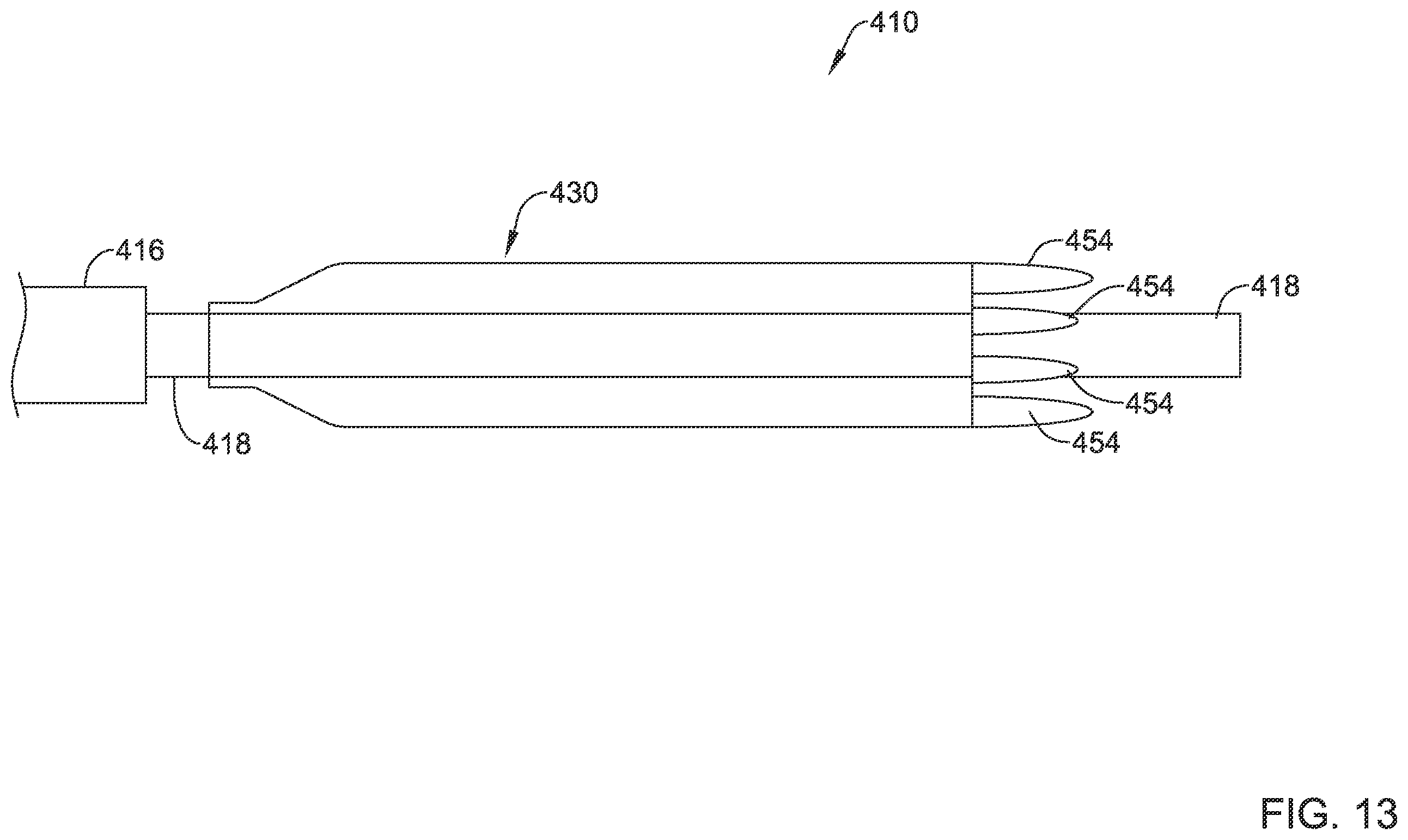 Patent US12551360 Figure 13 – Stent delivery system