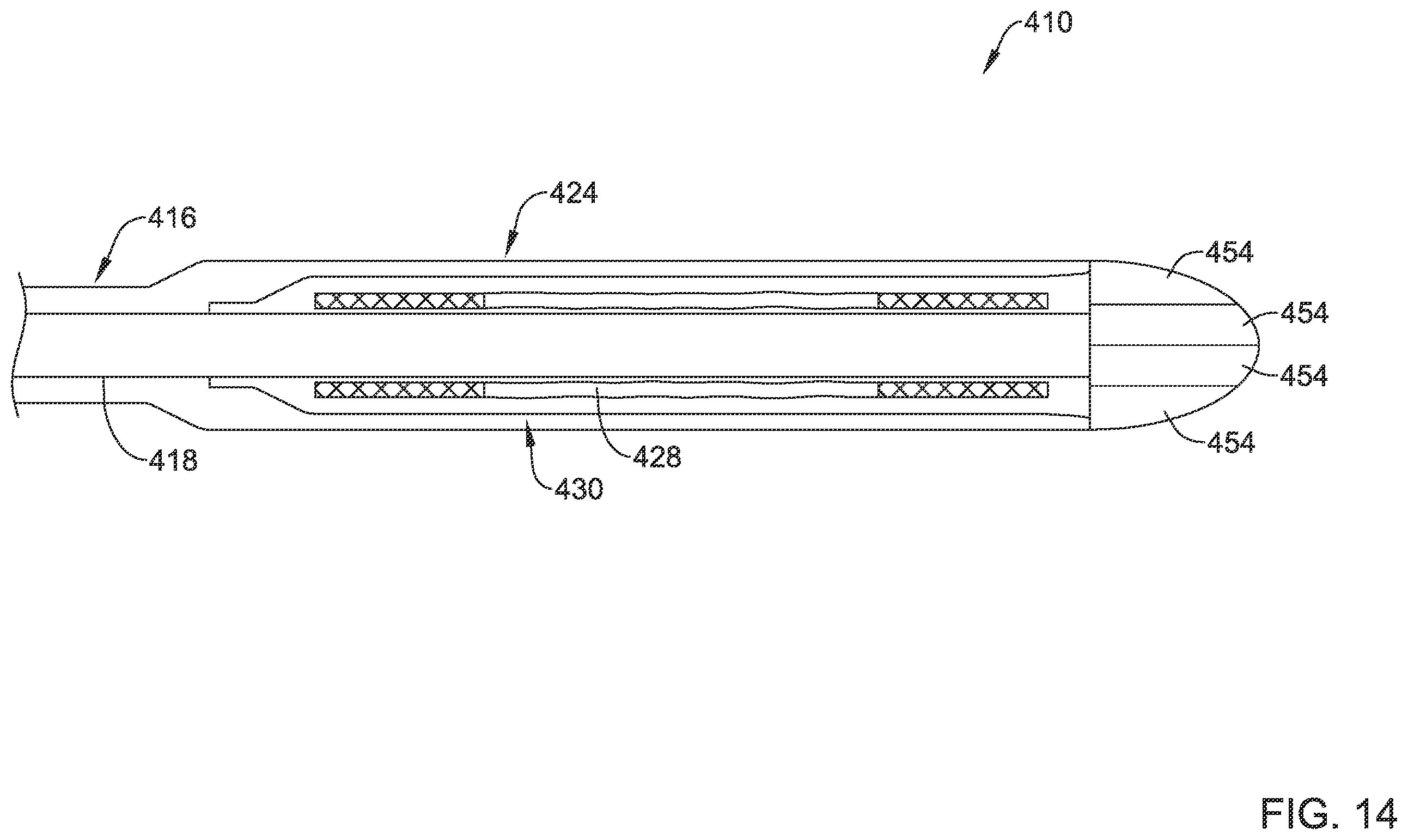 Patent US12551360 Figure 14 – Stent delivery system