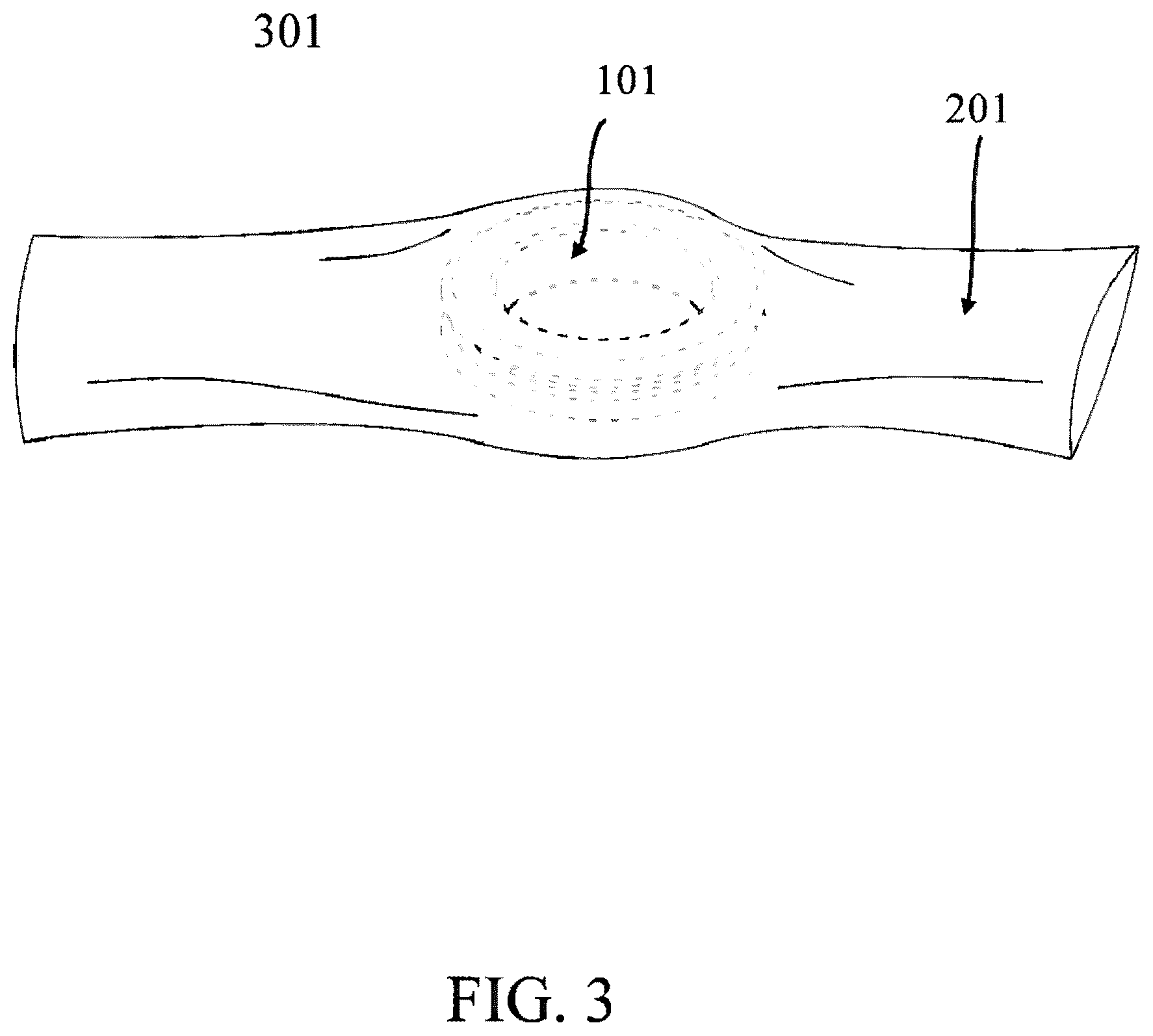 Patent US12551362 Figure 3 – Tennis elbow offloading device