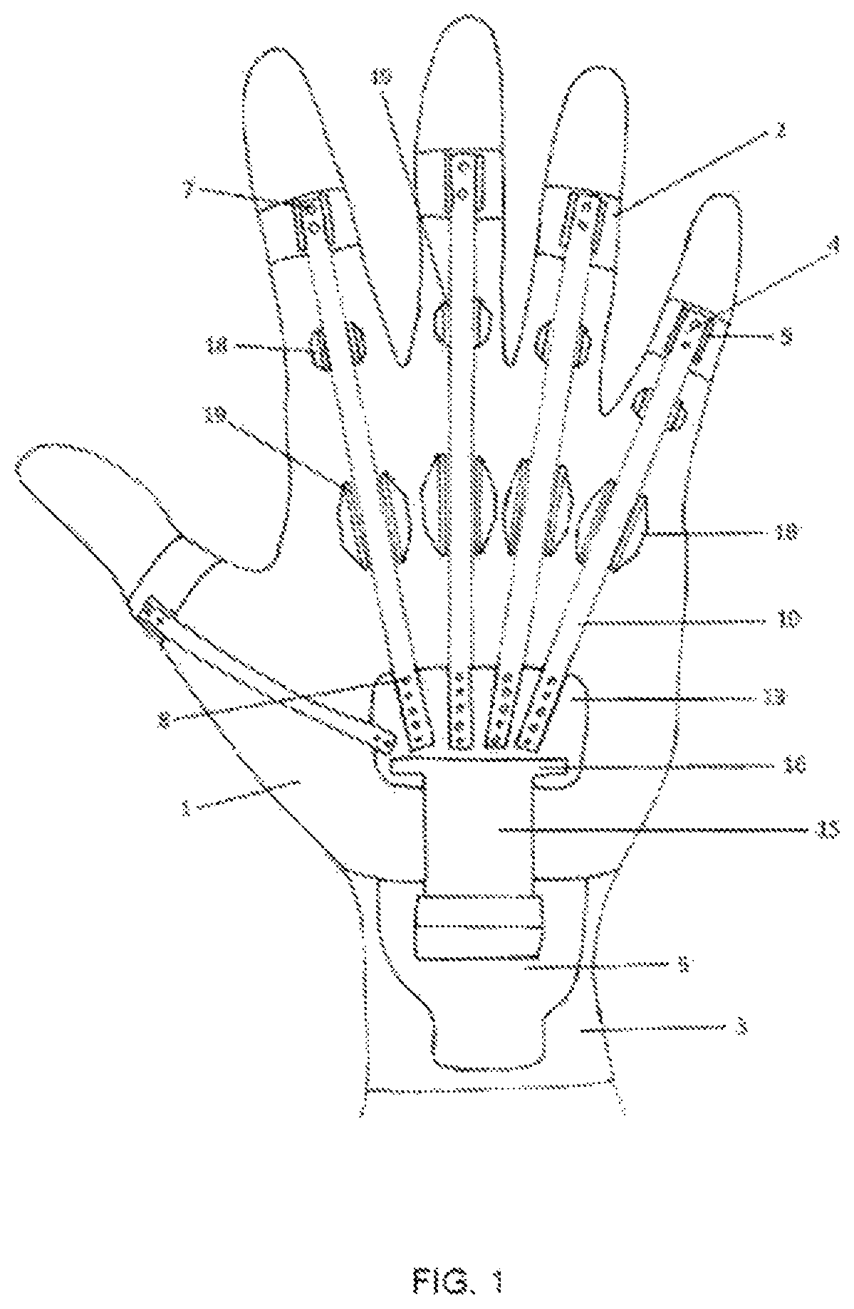 Patent US12551363 Figure 1 – Hand-and-wrist accessory device for people that facilitates extension movements