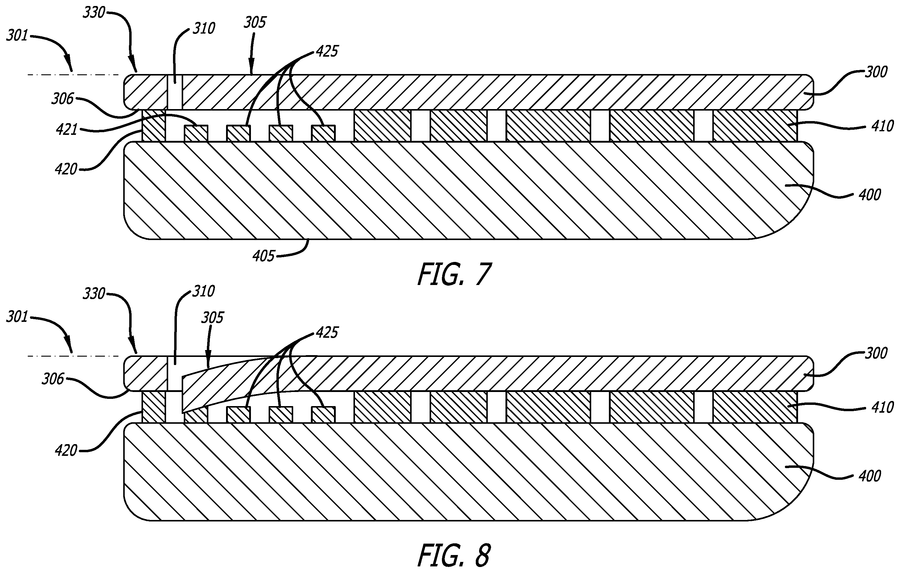Patent US12551364 Figure 7 – Orthopedic walking boot