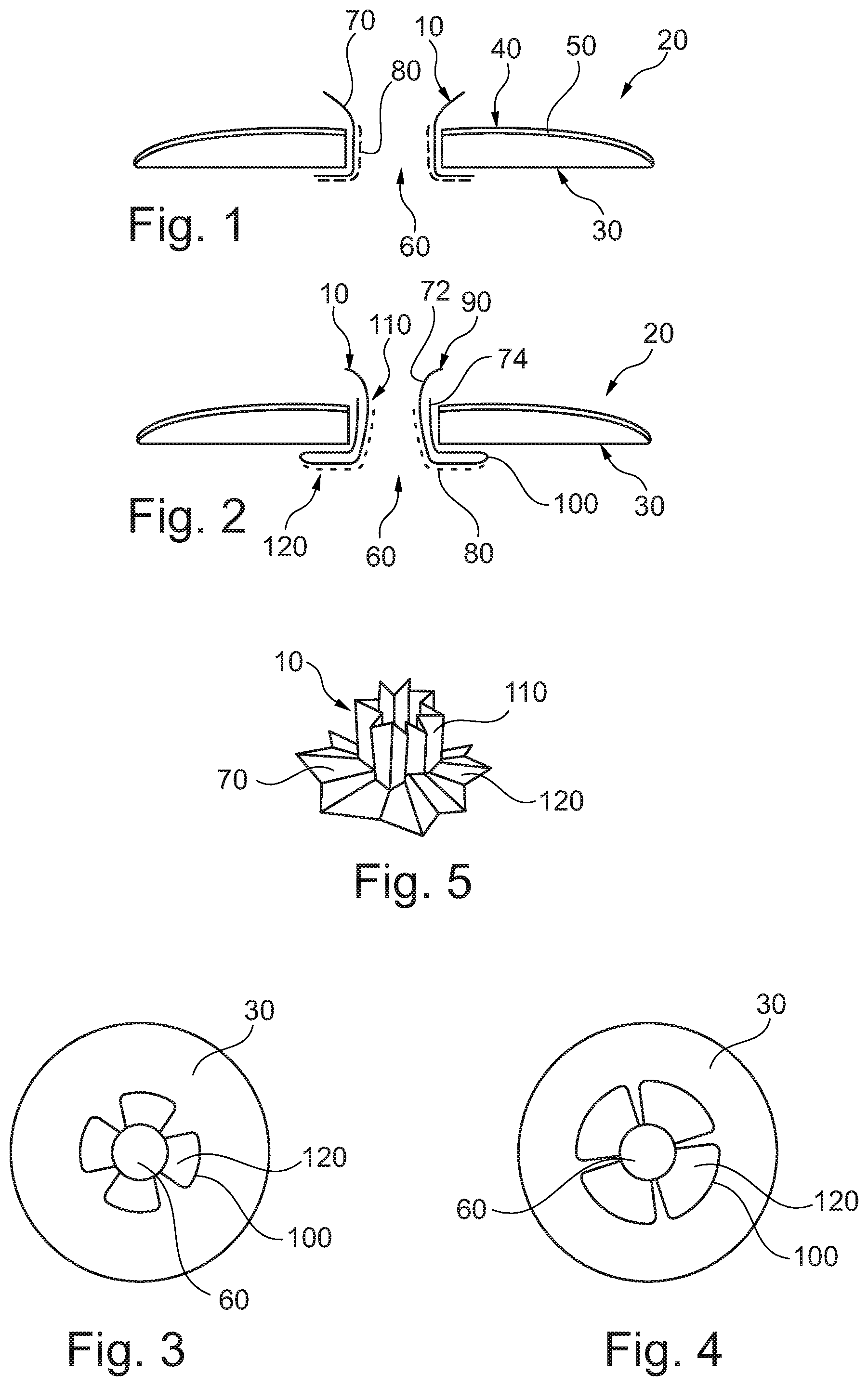 Patent US12551365 — Application aid for ostomy device — Figure 1