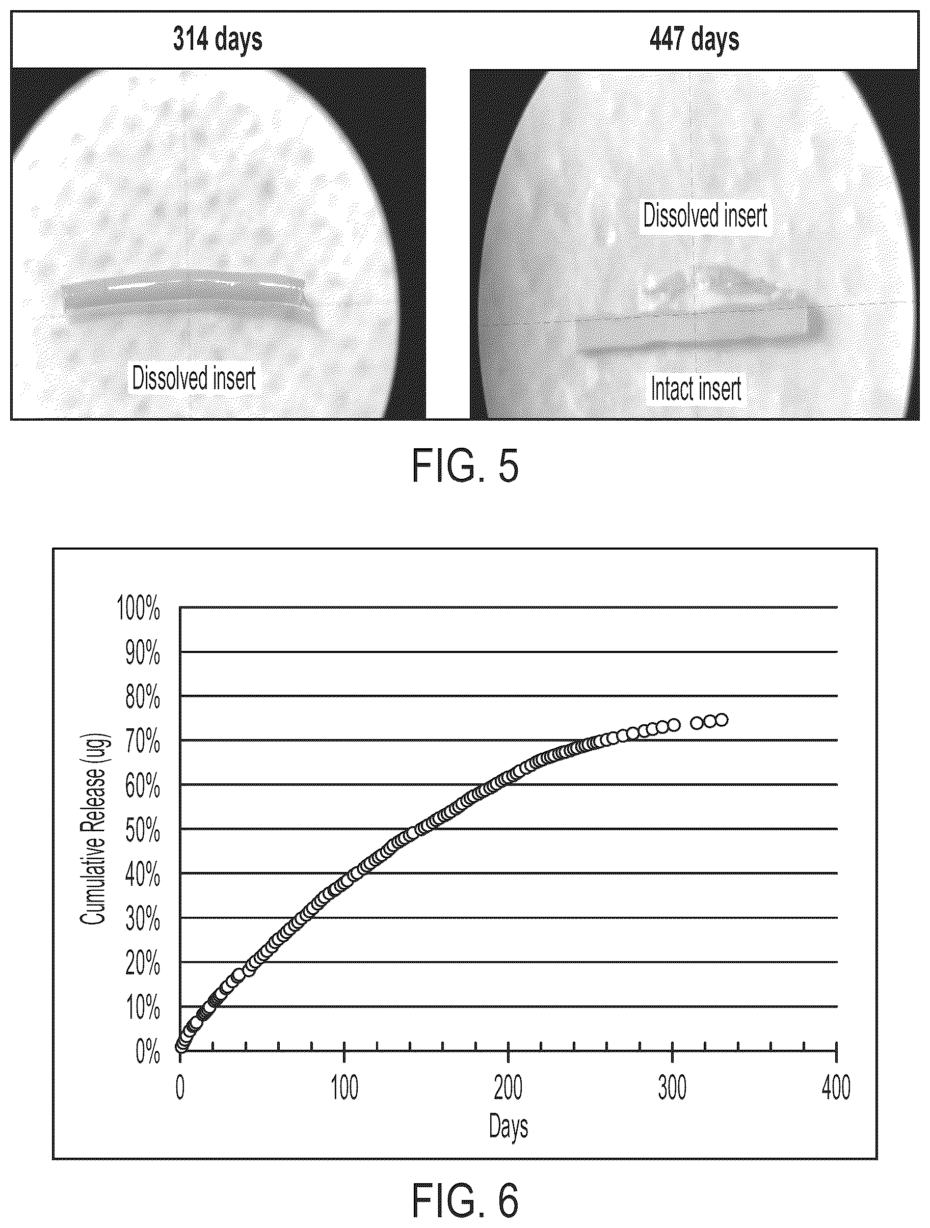 Patent US12551368 Figure 6 – Bioerodible ocular drug delivery insert and therapeutic method