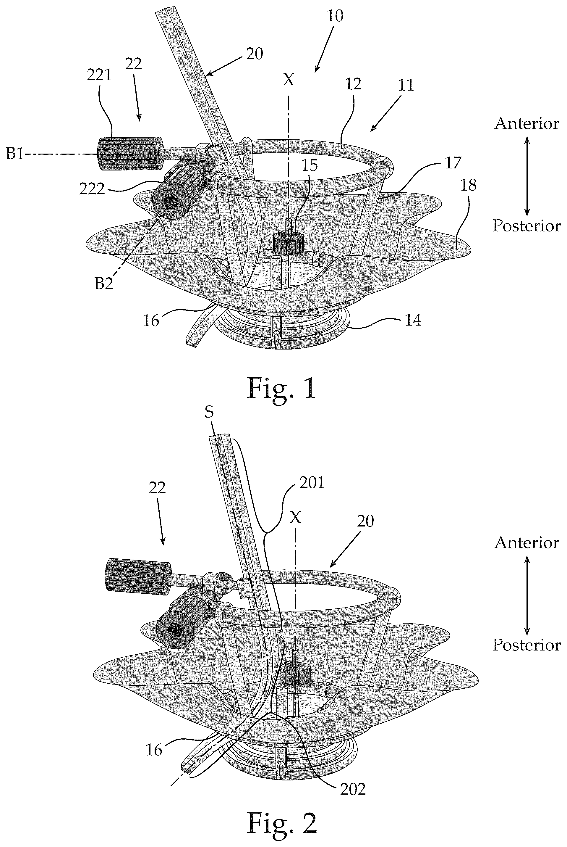 Patent US12551370 Figure 1 – Ocular platforms and surgical tools