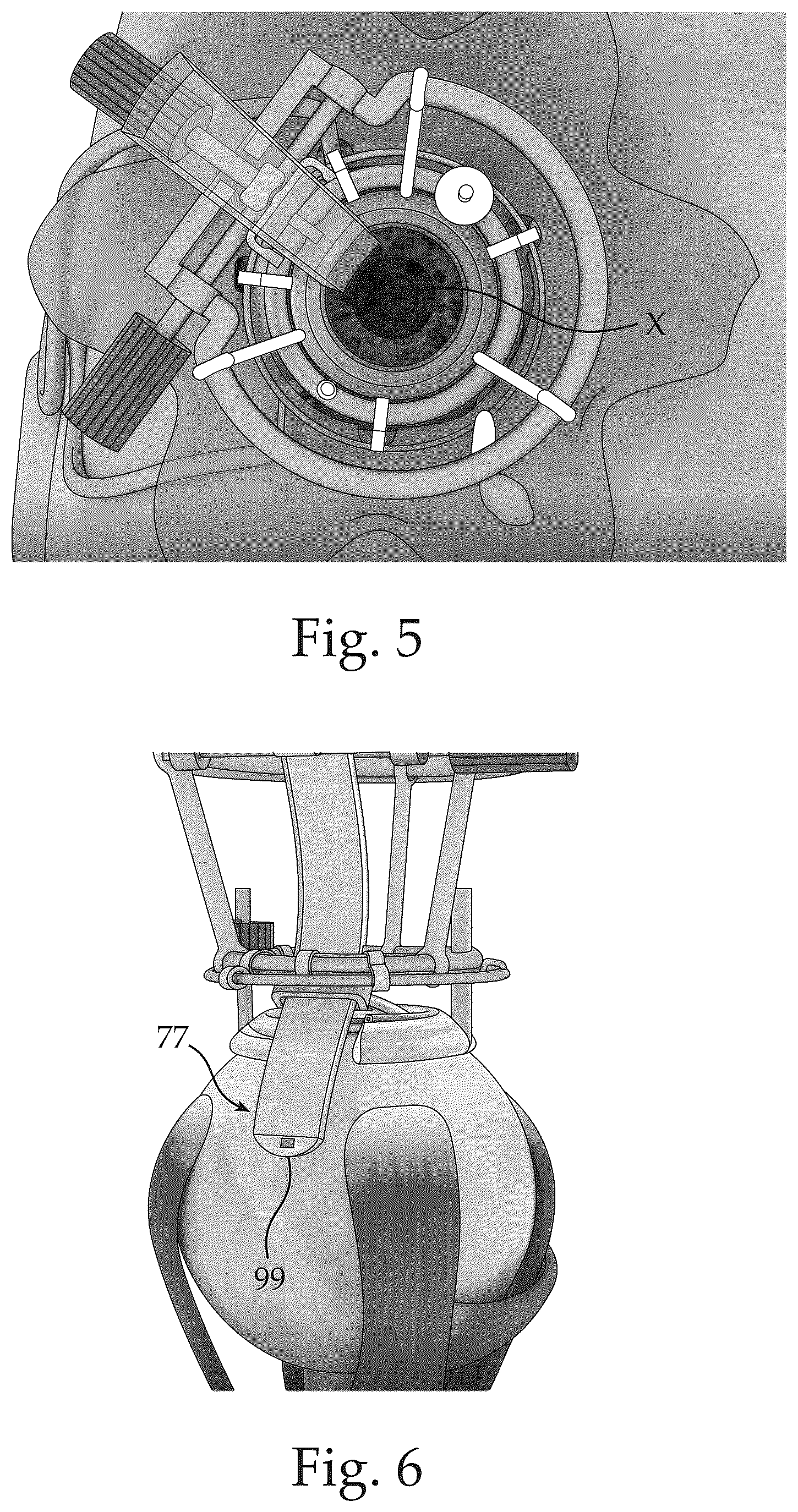 Patent US12551370 Figure 3 – Ocular platforms and surgical tools