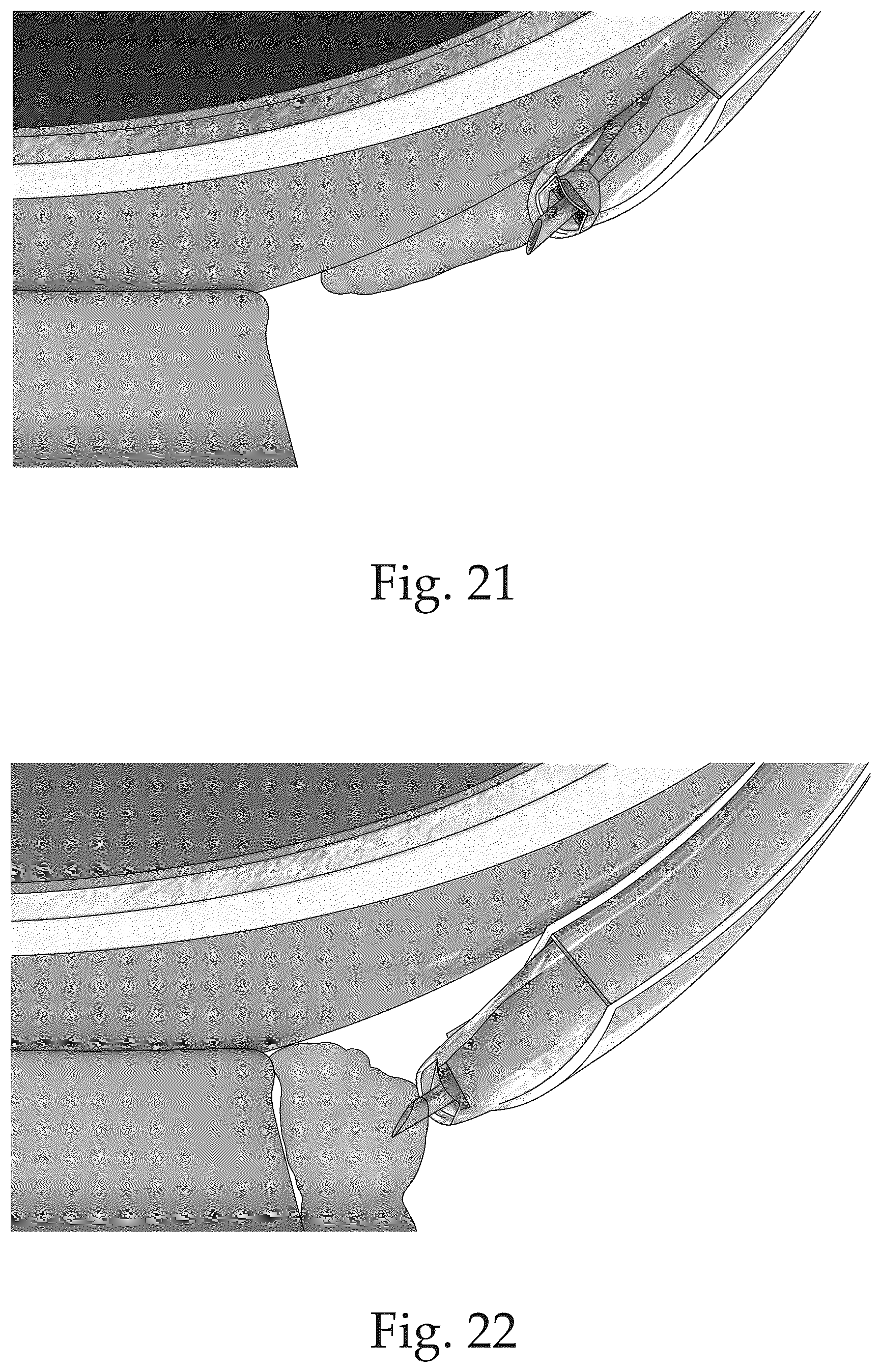 Patent US12551370 Figure 11 – Ocular platforms and surgical tools