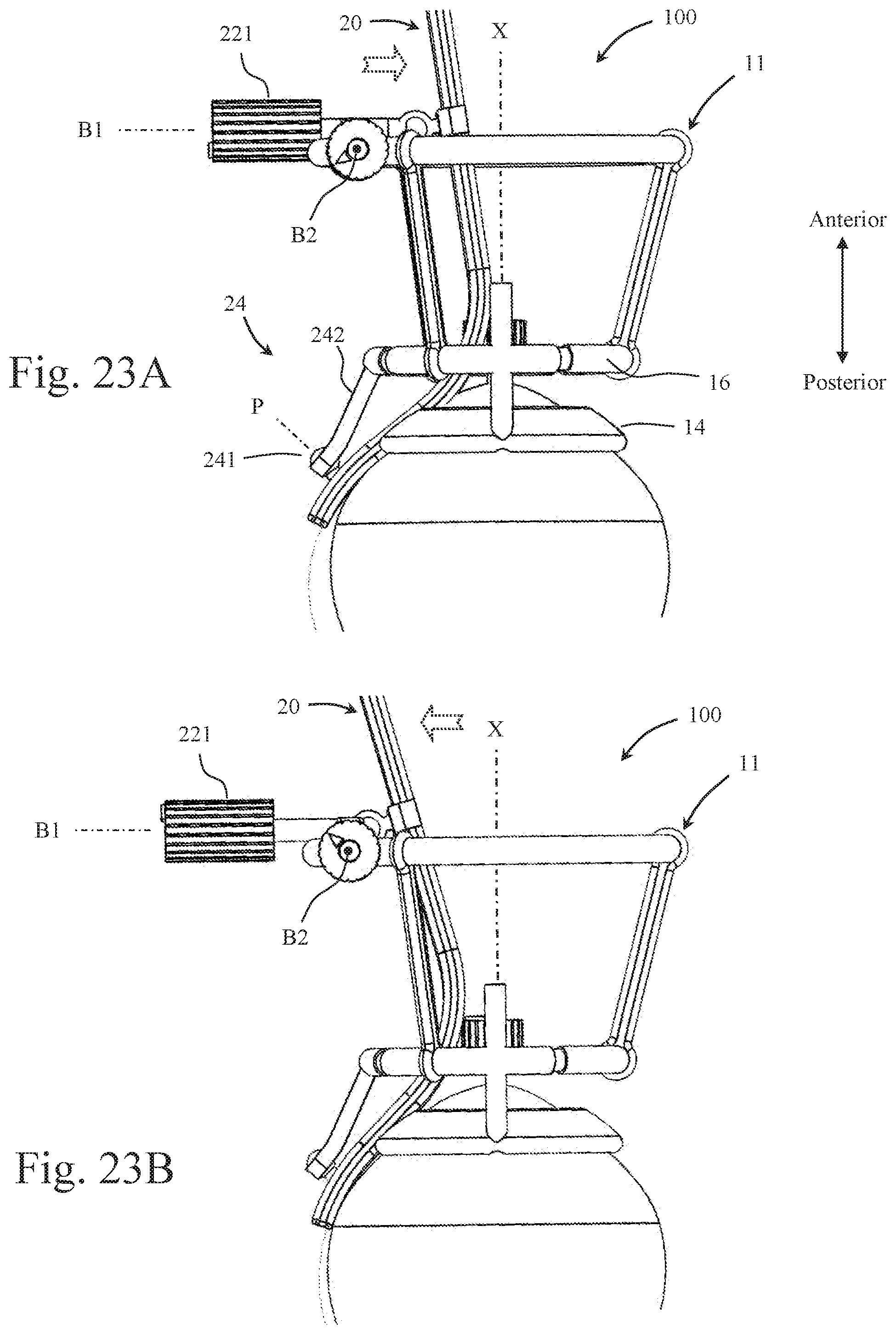Patent US12551370 Figure 12 – Ocular platforms and surgical tools
