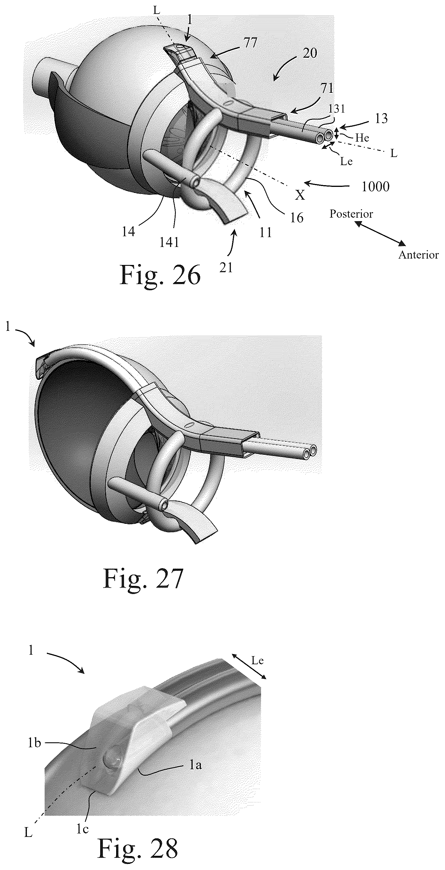 Patent US12551370 Figure 15 – Ocular platforms and surgical tools