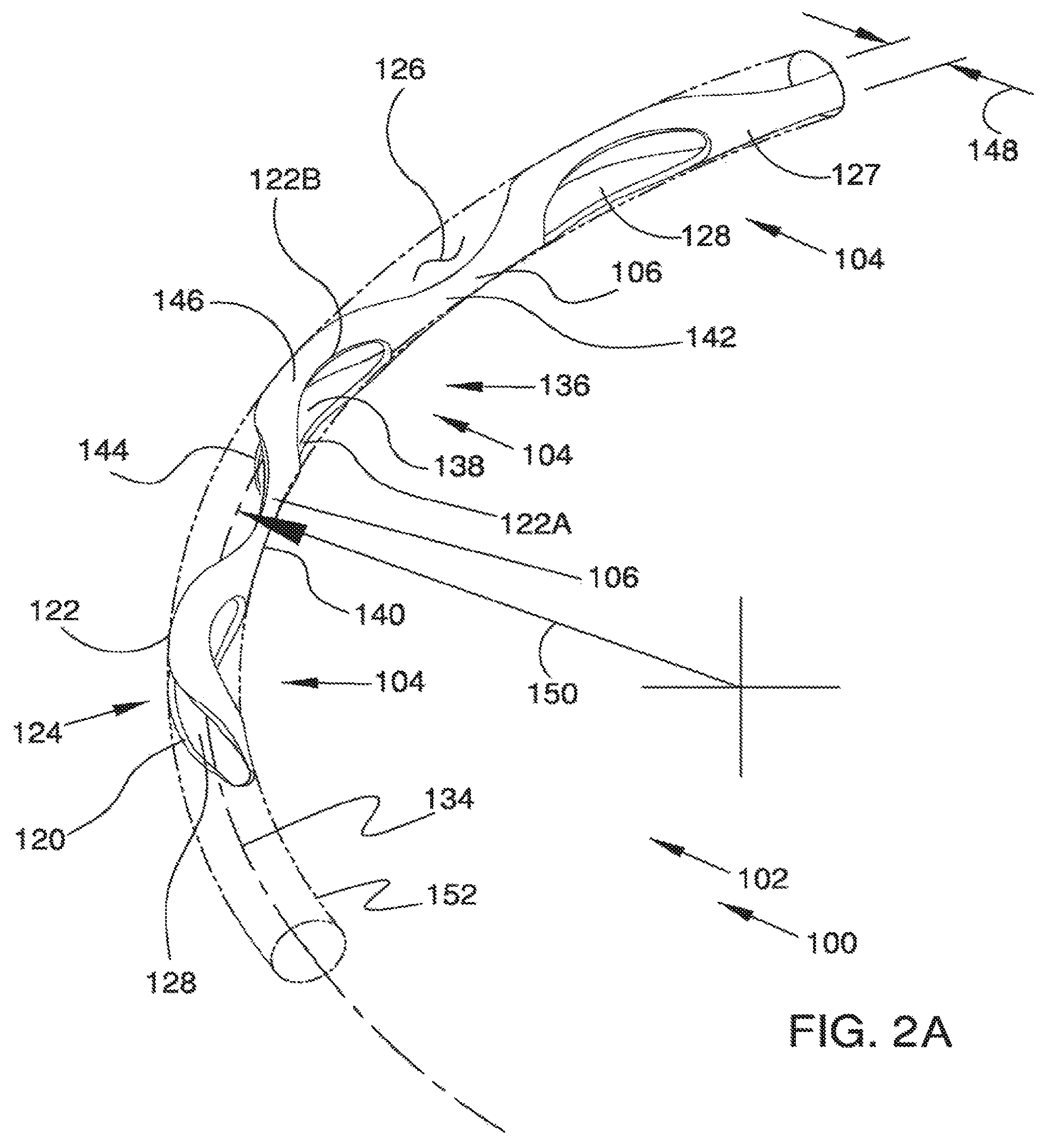 Patent US12551371 Figure 2 – Ocular implant and delivery system