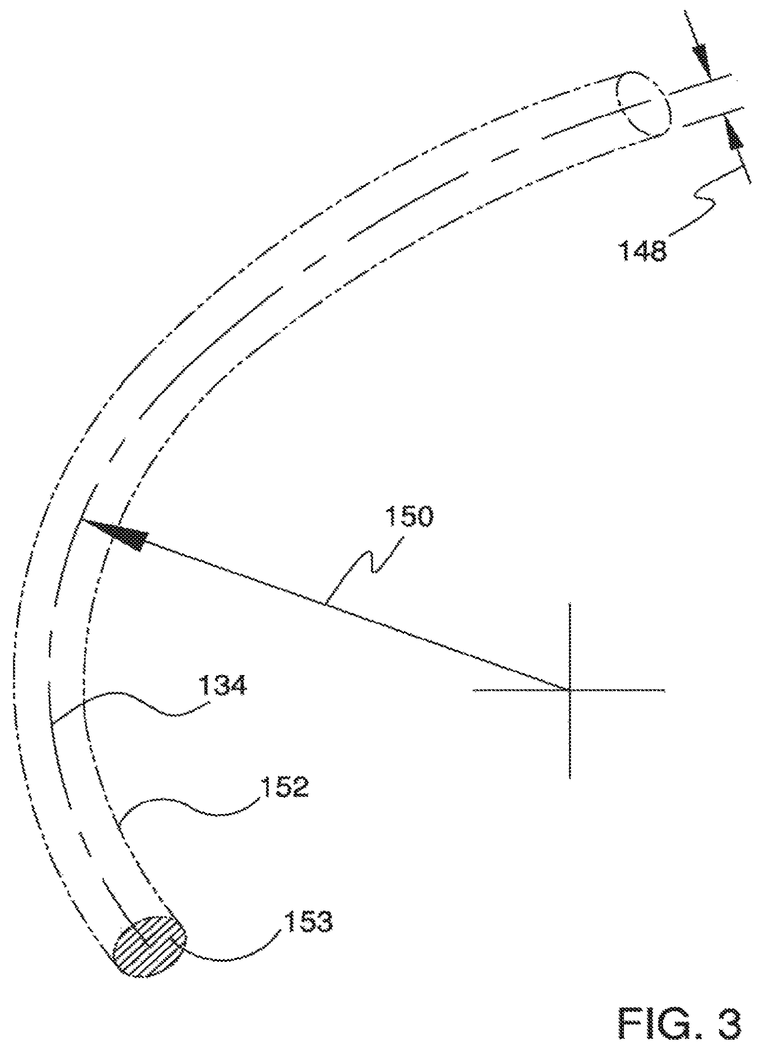 Patent US12551371 Figure 4 – Ocular implant and delivery system