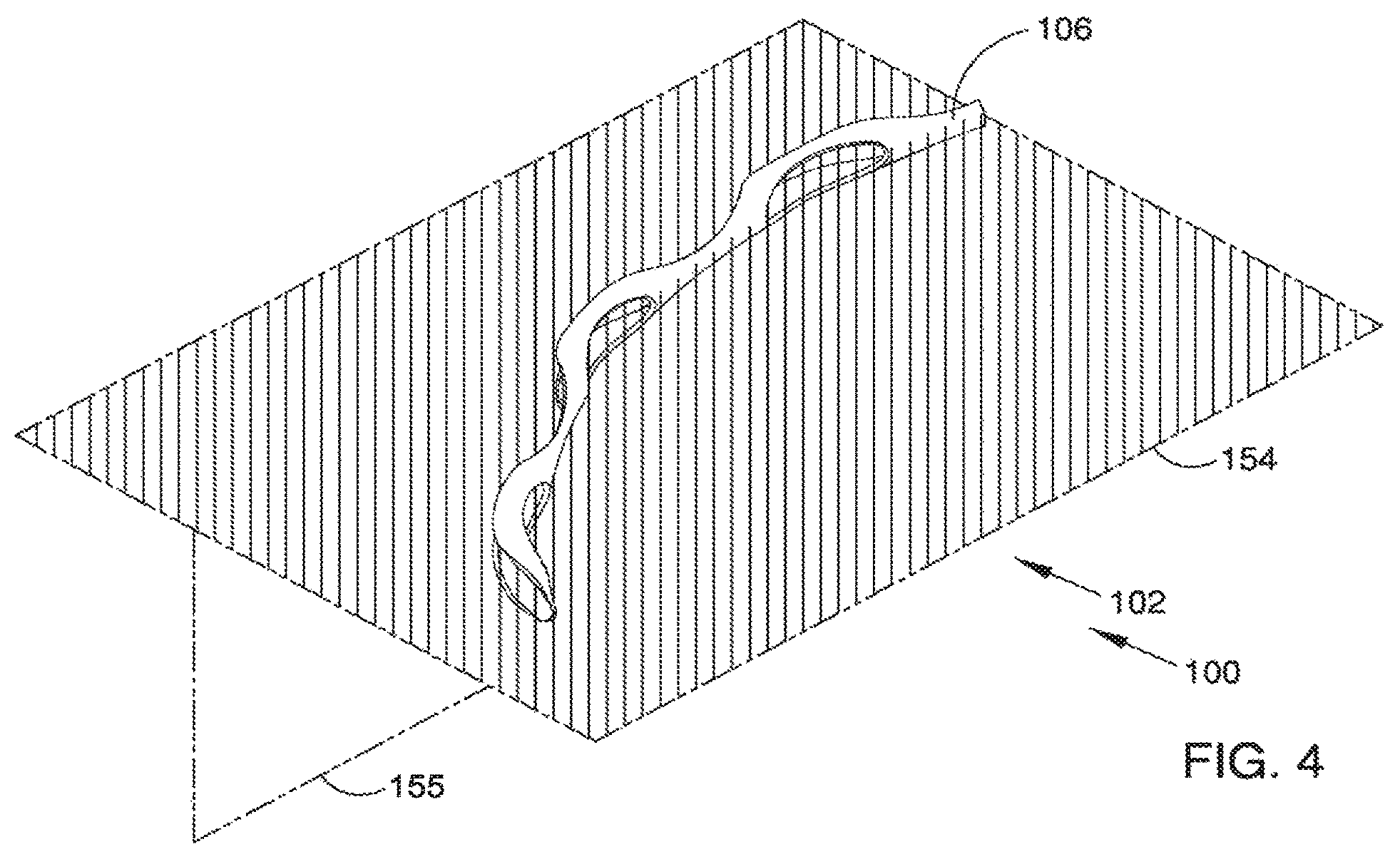 Patent US12551371 Figure 5 – Ocular implant and delivery system
