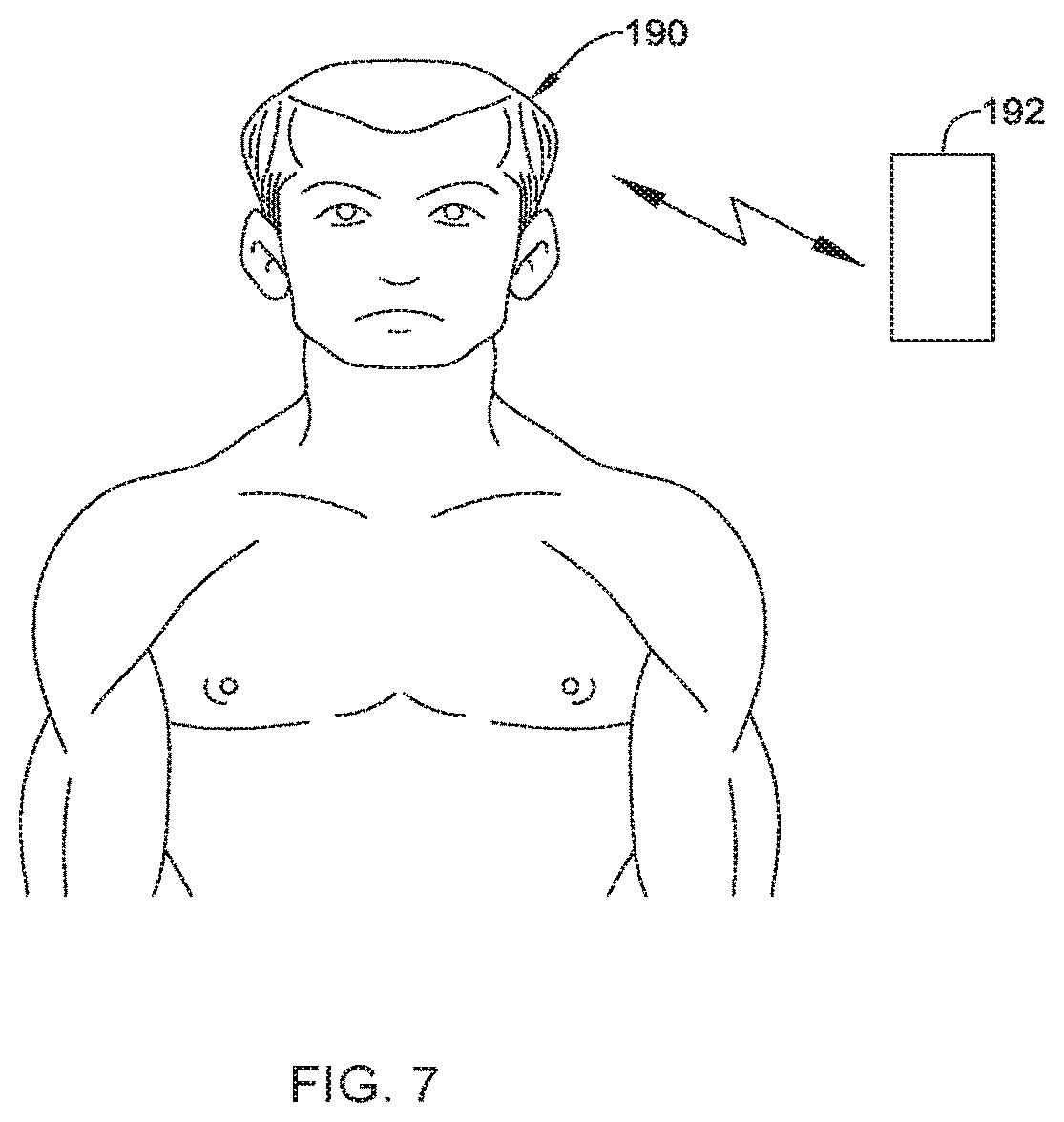 Patent US12551371 Figure 10 – Ocular implant and delivery system