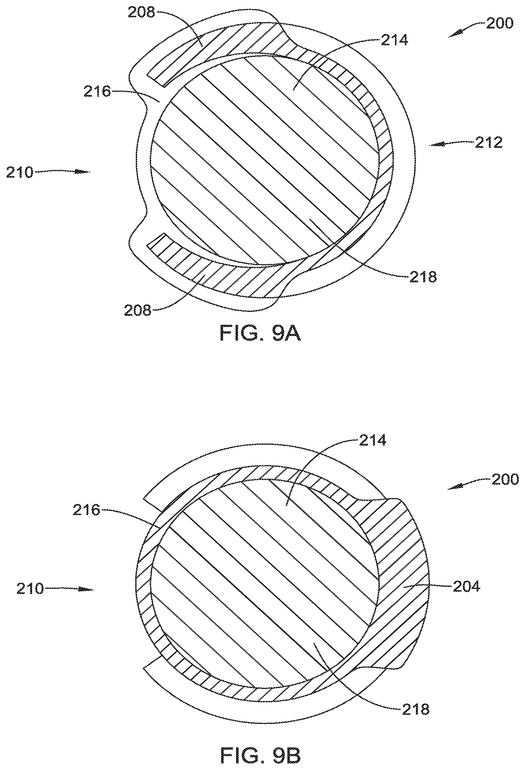 Patent US12551371 Figure 12 – Ocular implant and delivery system