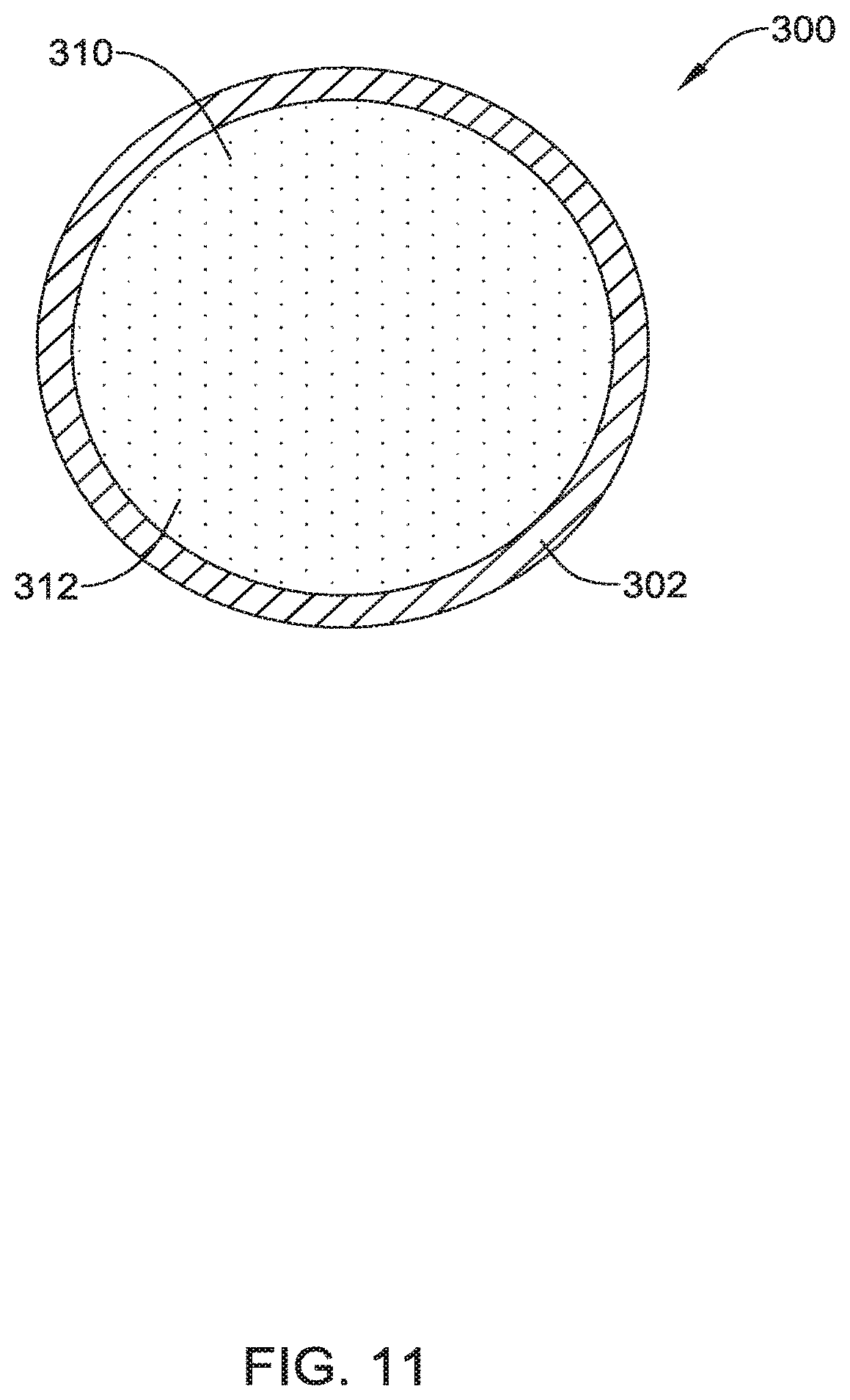 Patent US12551371 Figure 14 – Ocular implant and delivery system