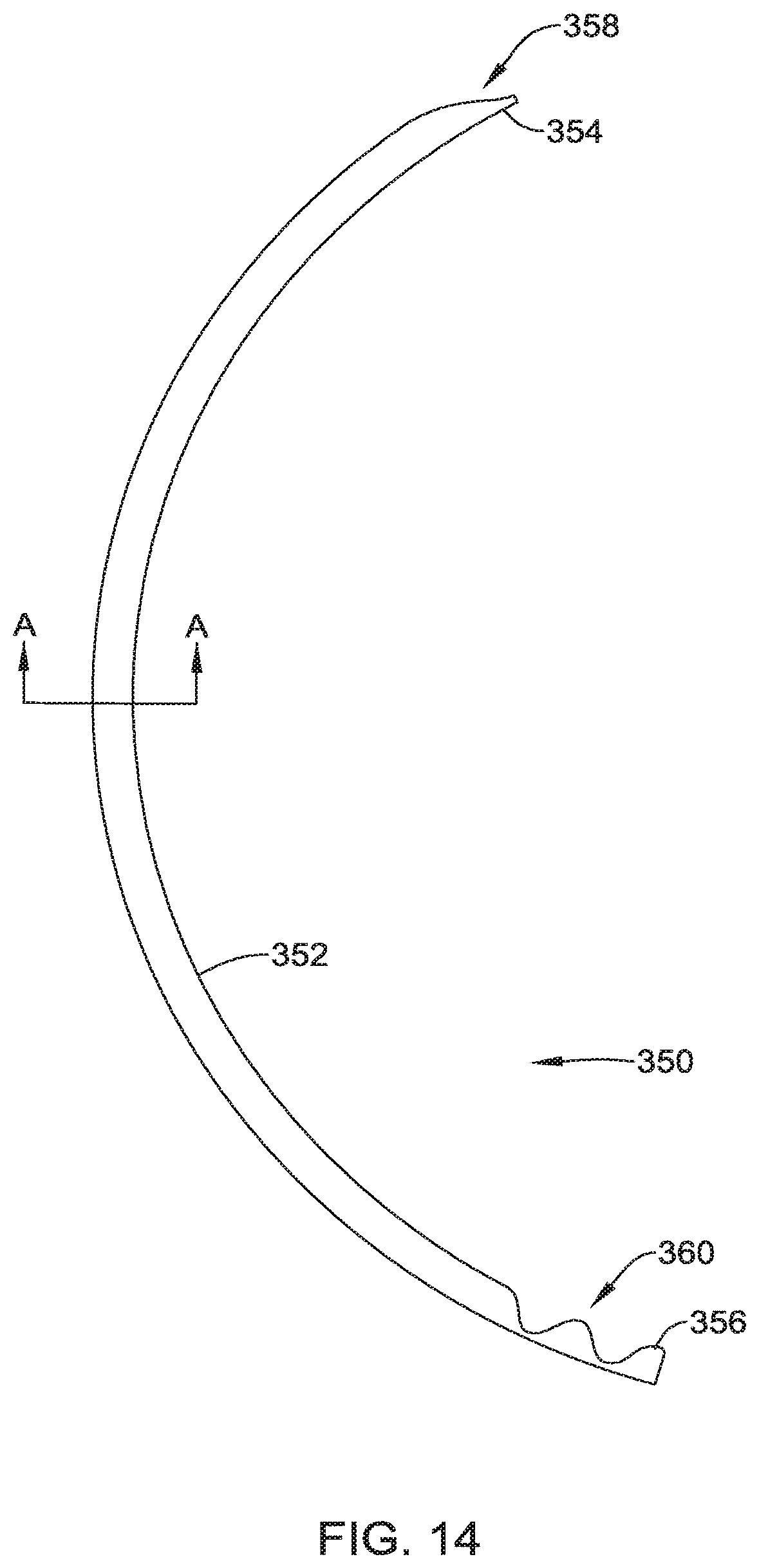 Patent US12551371 Figure 17 – Ocular implant and delivery system