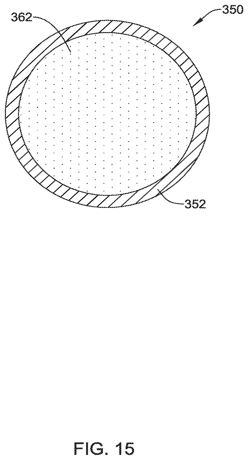 Patent US12551371 Figure 18 – Ocular implant and delivery system