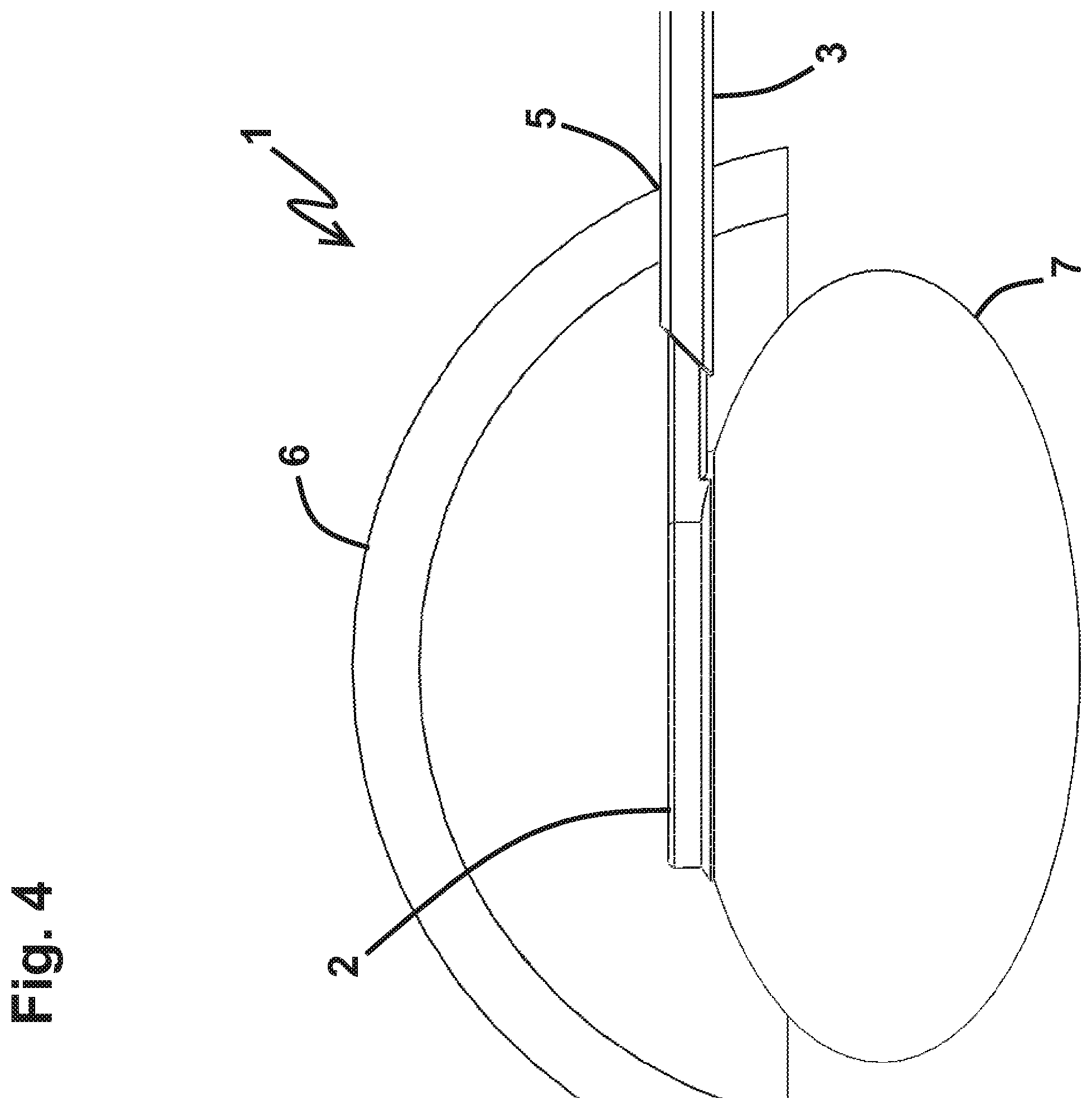 Patent US12551372 Figure 6 – Capsulotomy device