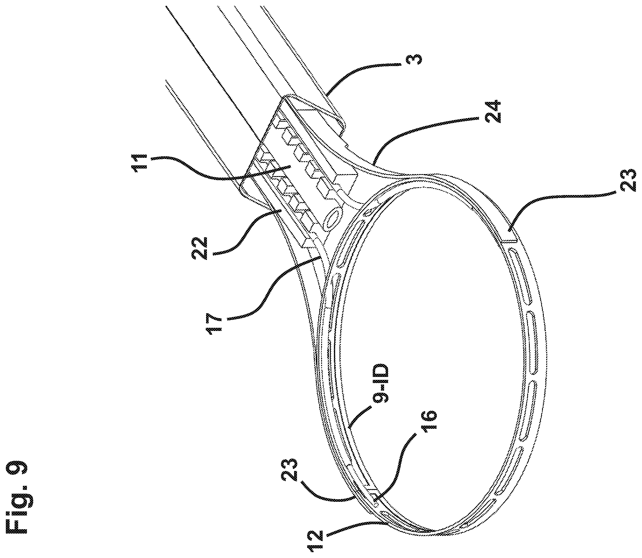 Patent US12551372 Figure 11 – Capsulotomy device