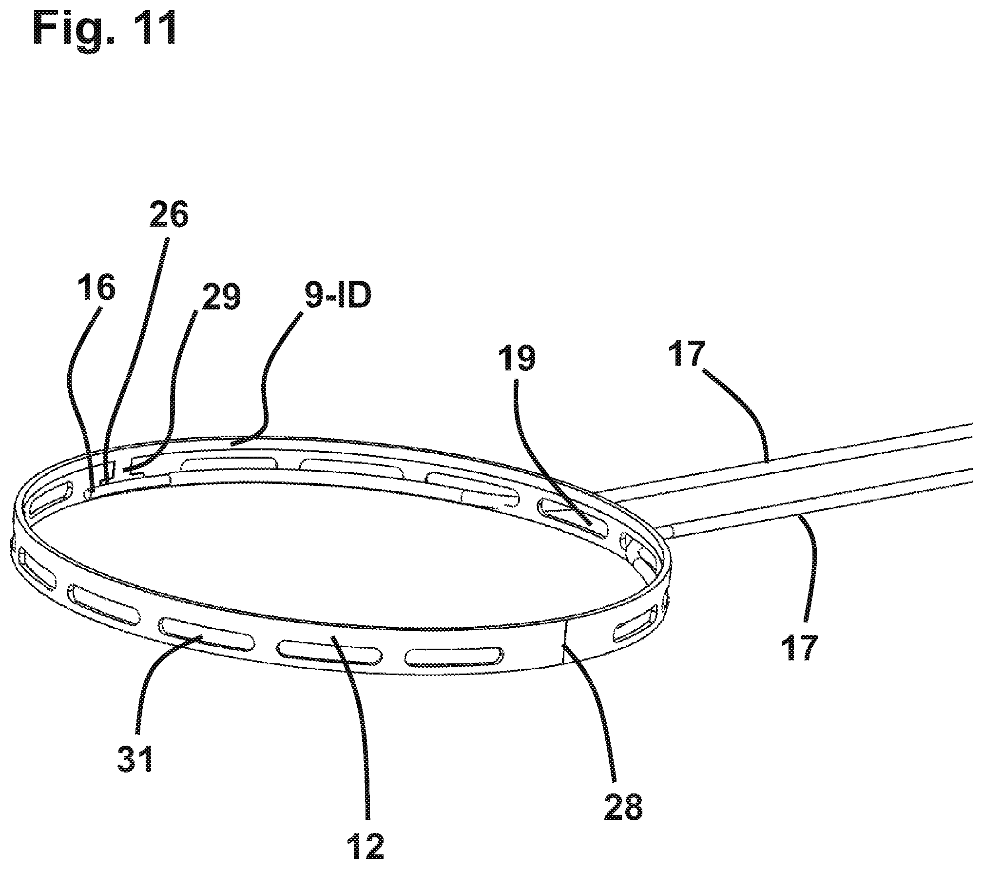 Patent US12551372 Figure 13 – Capsulotomy device