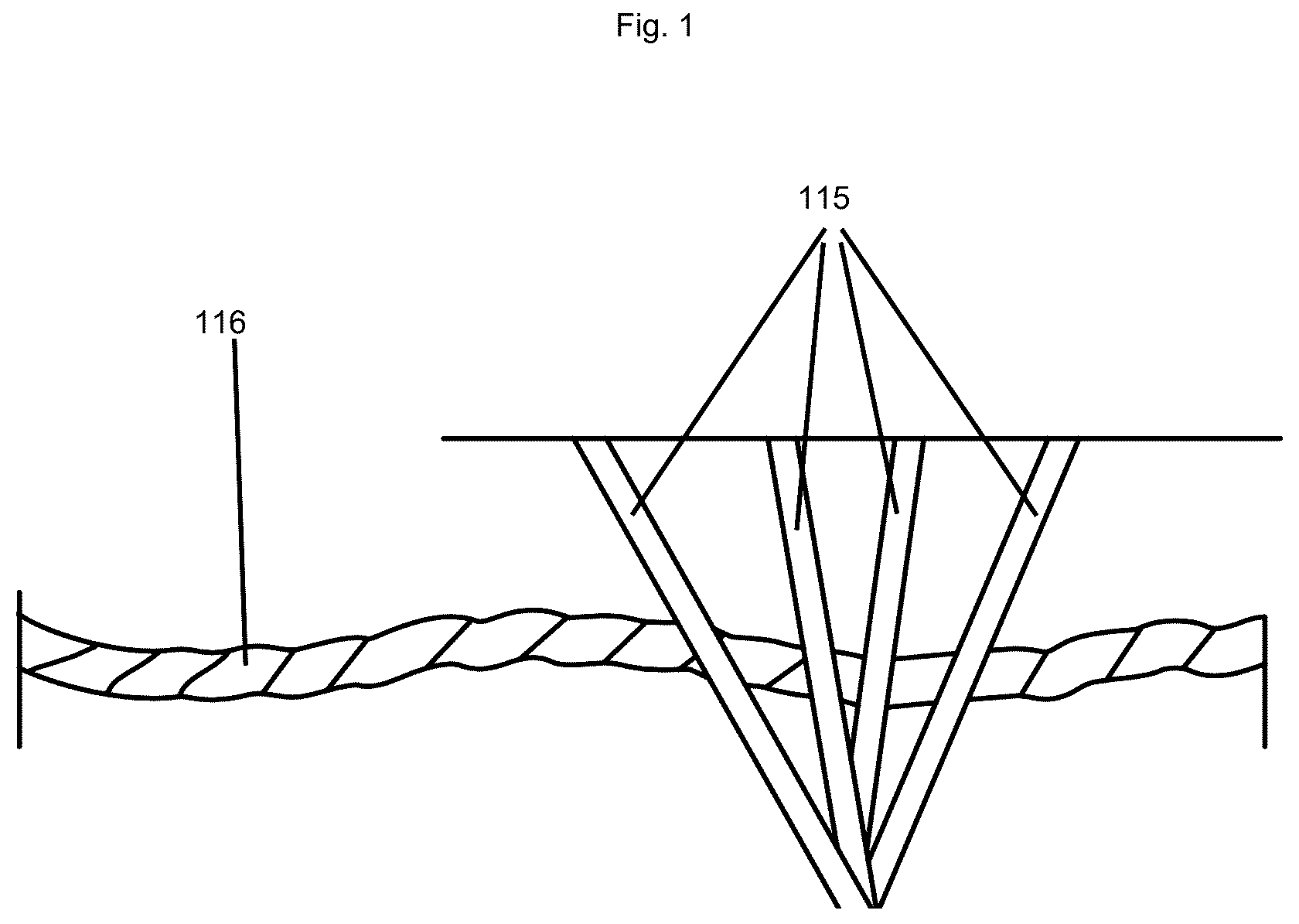 Patent US12551373 — Vitrectomy device — Figure 1