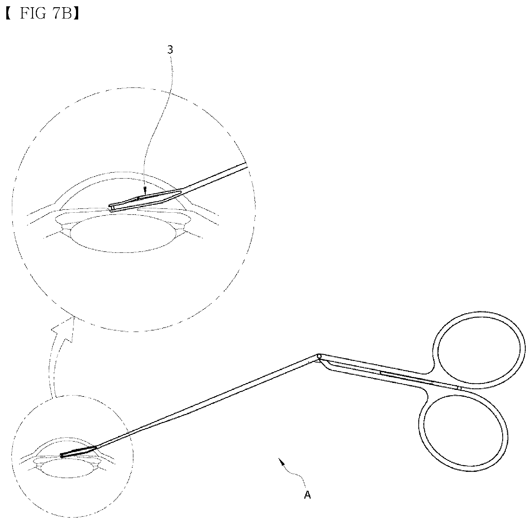 Patent US12551374 Figure 8 – Punching-type iridotomy instrument