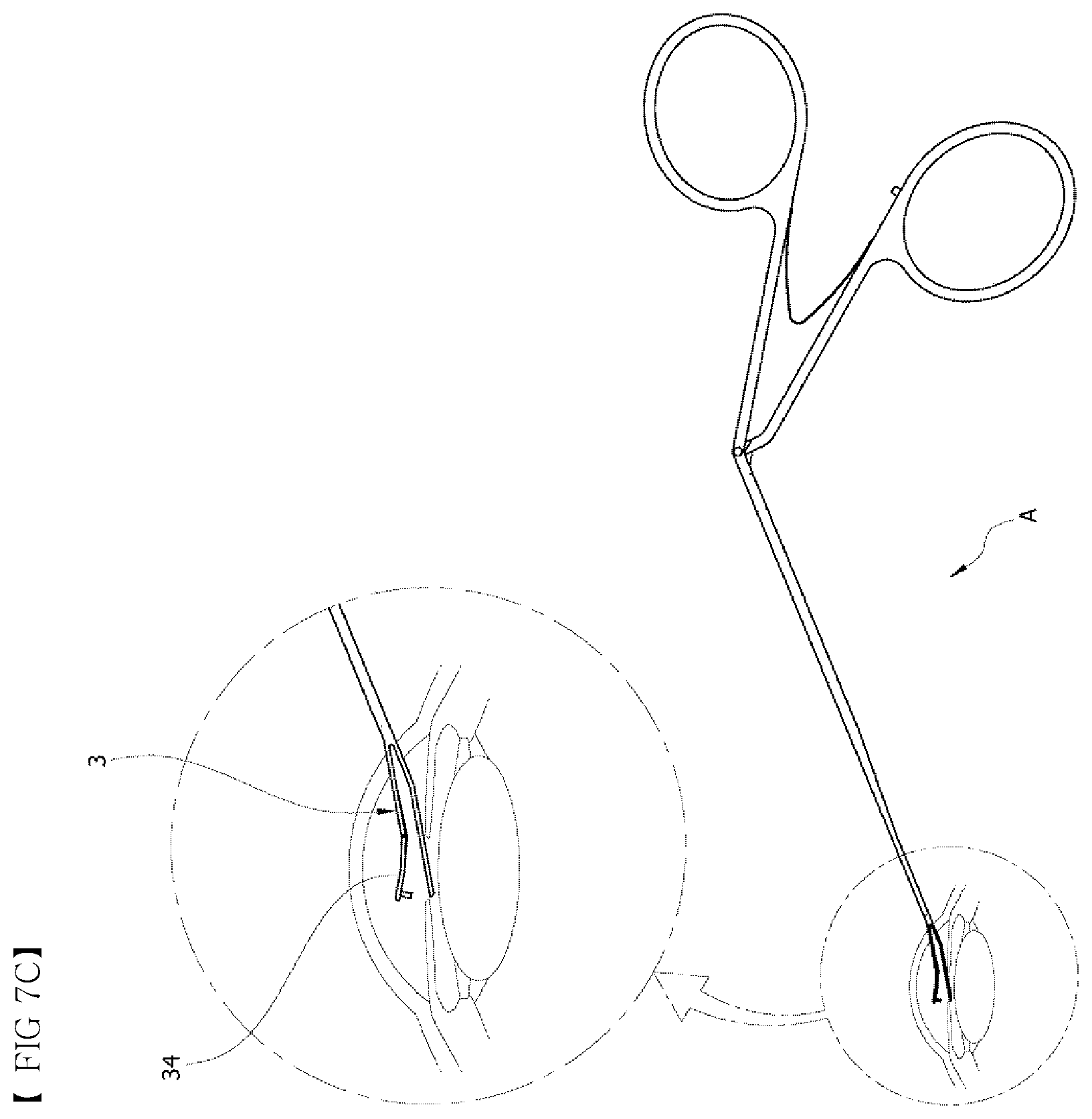 Patent US12551374 Figure 9 – Punching-type iridotomy instrument