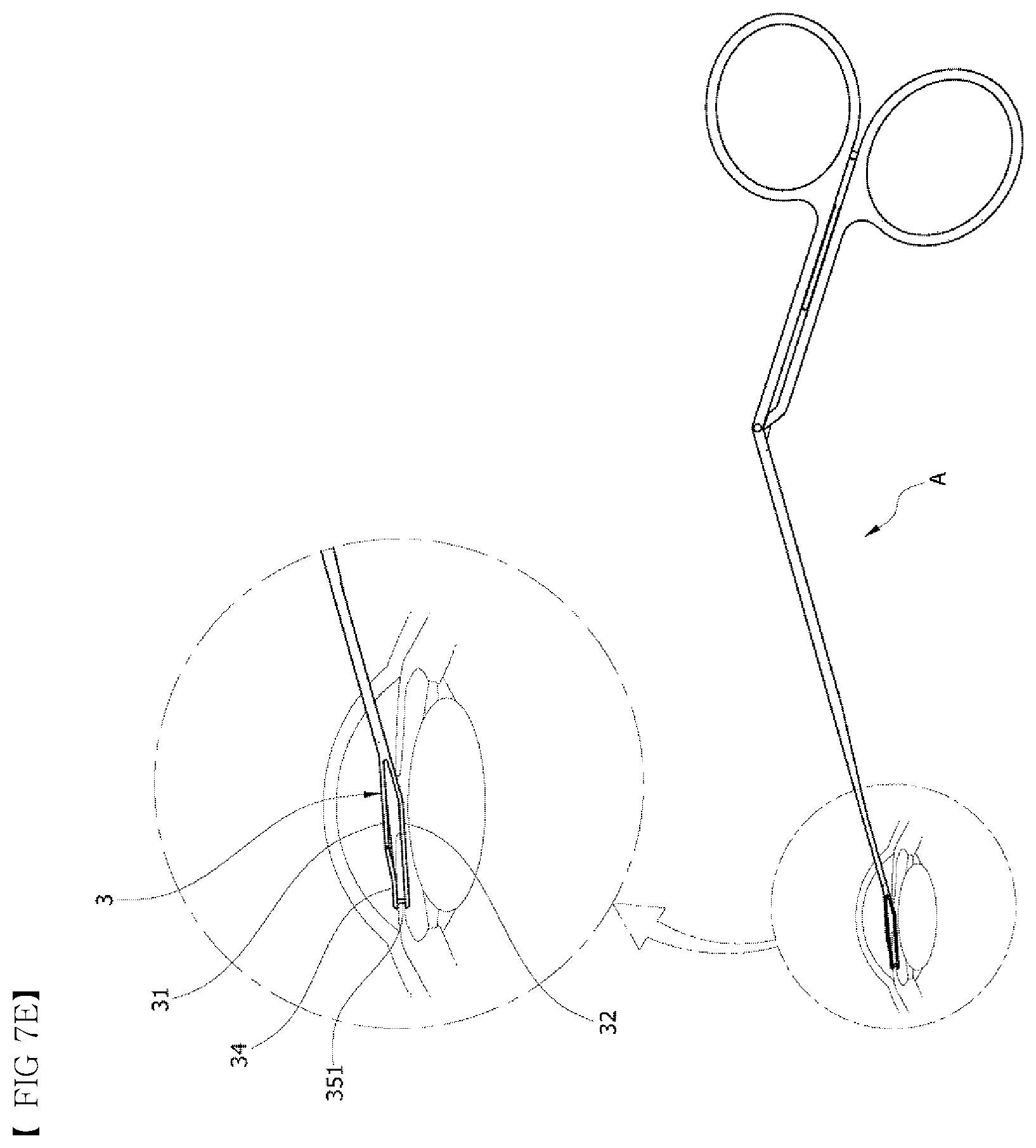 Patent US12551374 Figure 11 – Punching-type iridotomy instrument