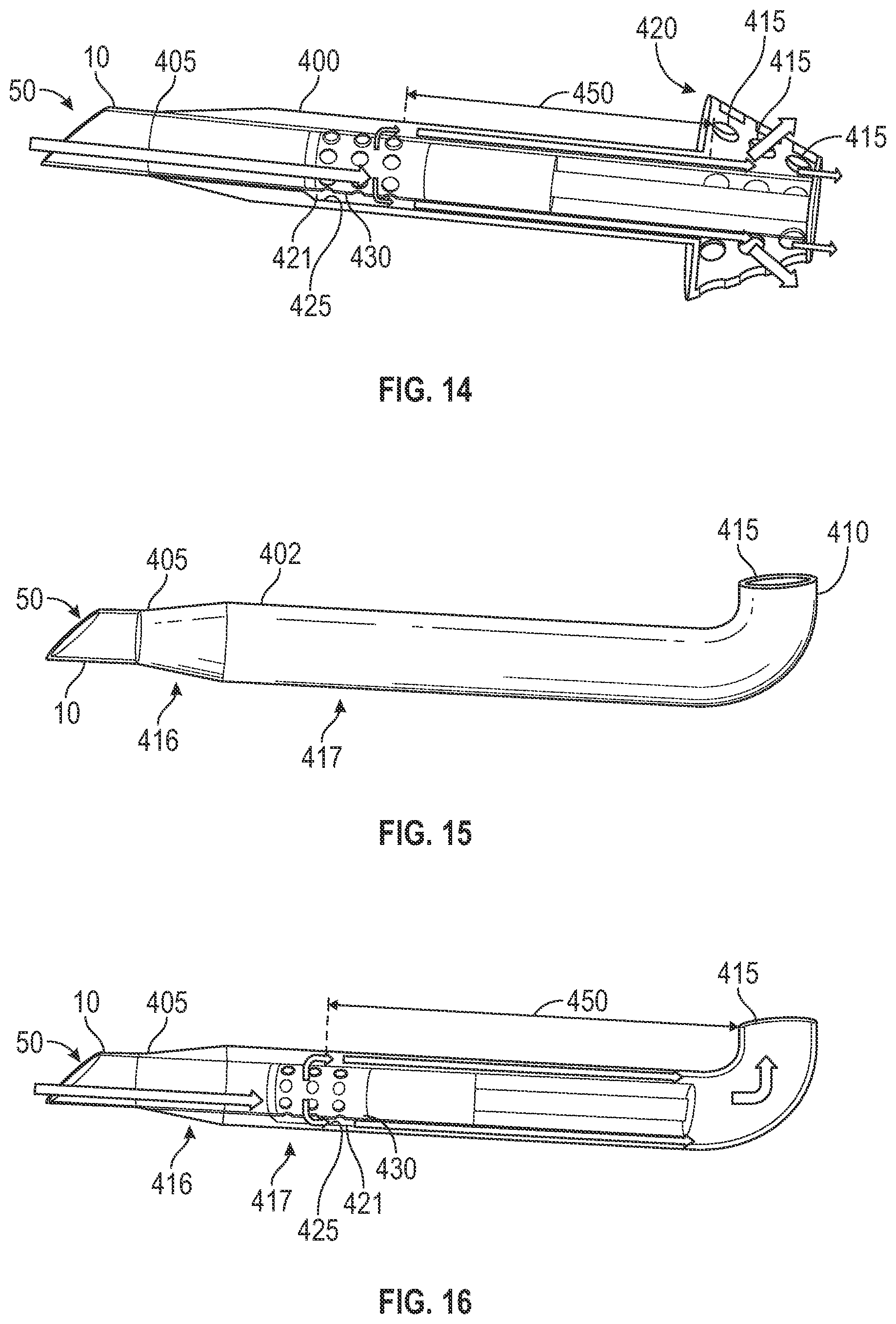 Patent US12551375 Figure 10 – Biofluid shunt valve with sheath and monitoring device