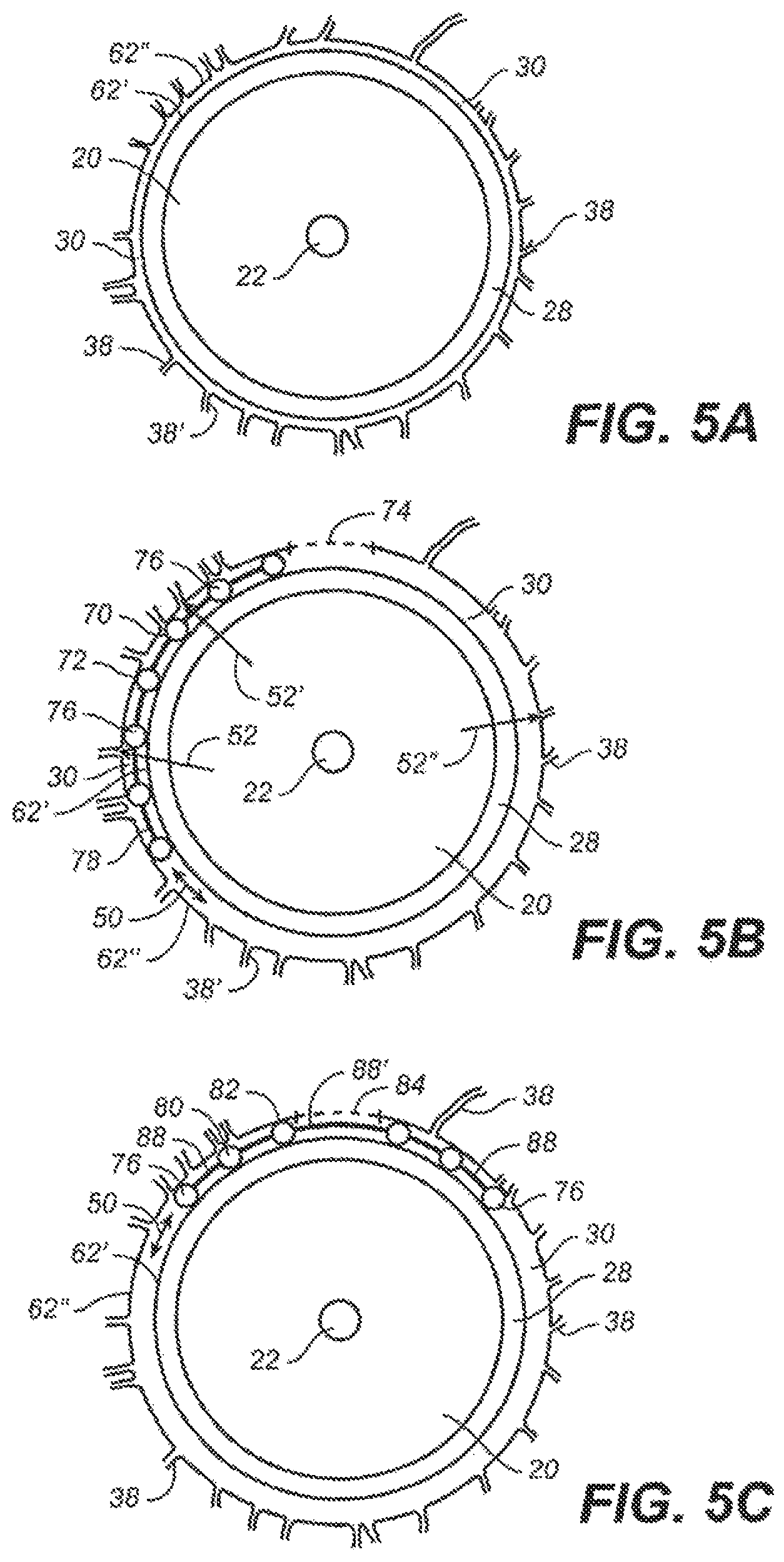 Patent US12551376 Figure 5 – Intraocular implants and methods and kits therefor