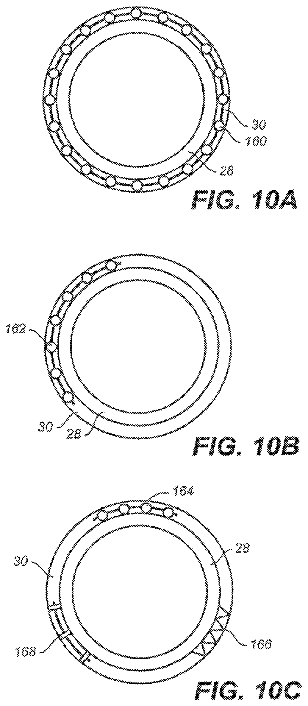 Patent US12551376 Figure 10 – Intraocular implants and methods and kits therefor