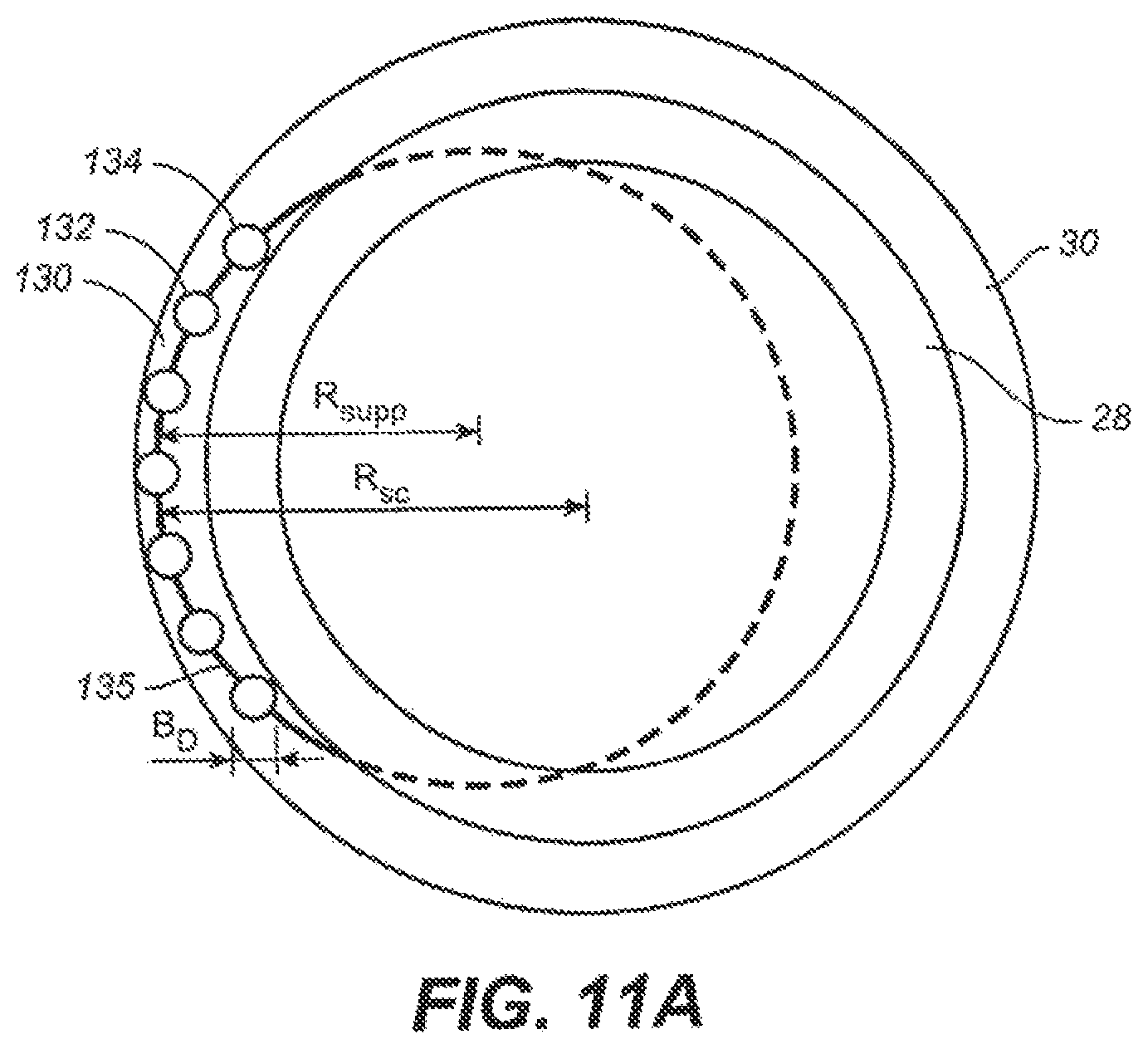 Patent US12551376 Figure 11 – Intraocular implants and methods and kits therefor