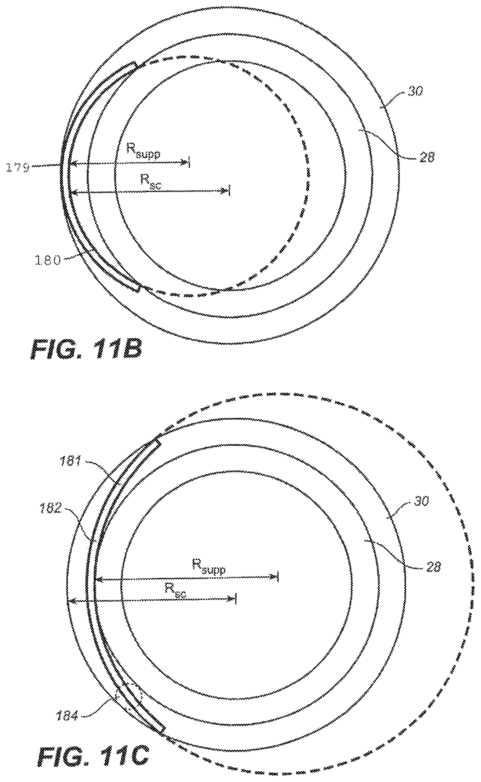 Patent US12551376 Figure 12 – Intraocular implants and methods and kits therefor