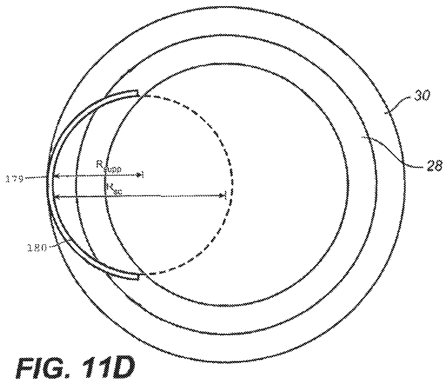 Patent US12551376 Figure 13 – Intraocular implants and methods and kits therefor