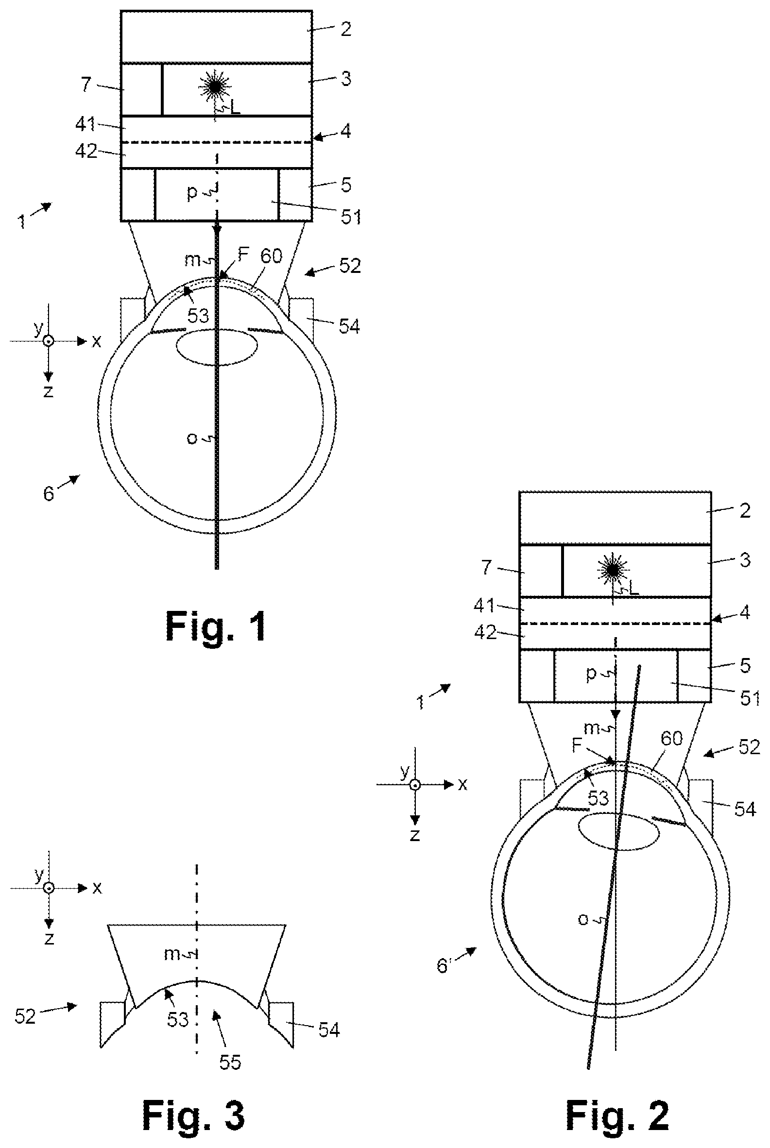 Patent US12551377 Figure 1 – Device for treating eye tissue by means of a pulsed laser beam