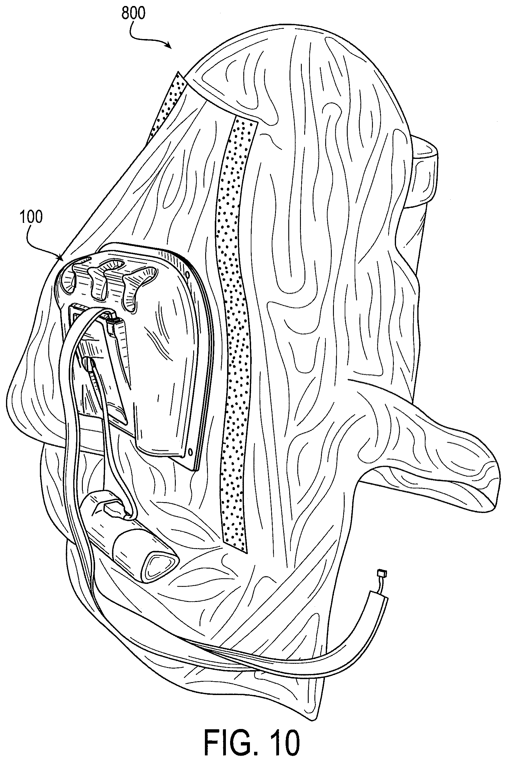 Patent US12551378 Figure 11 – Ventilation unit and controller device