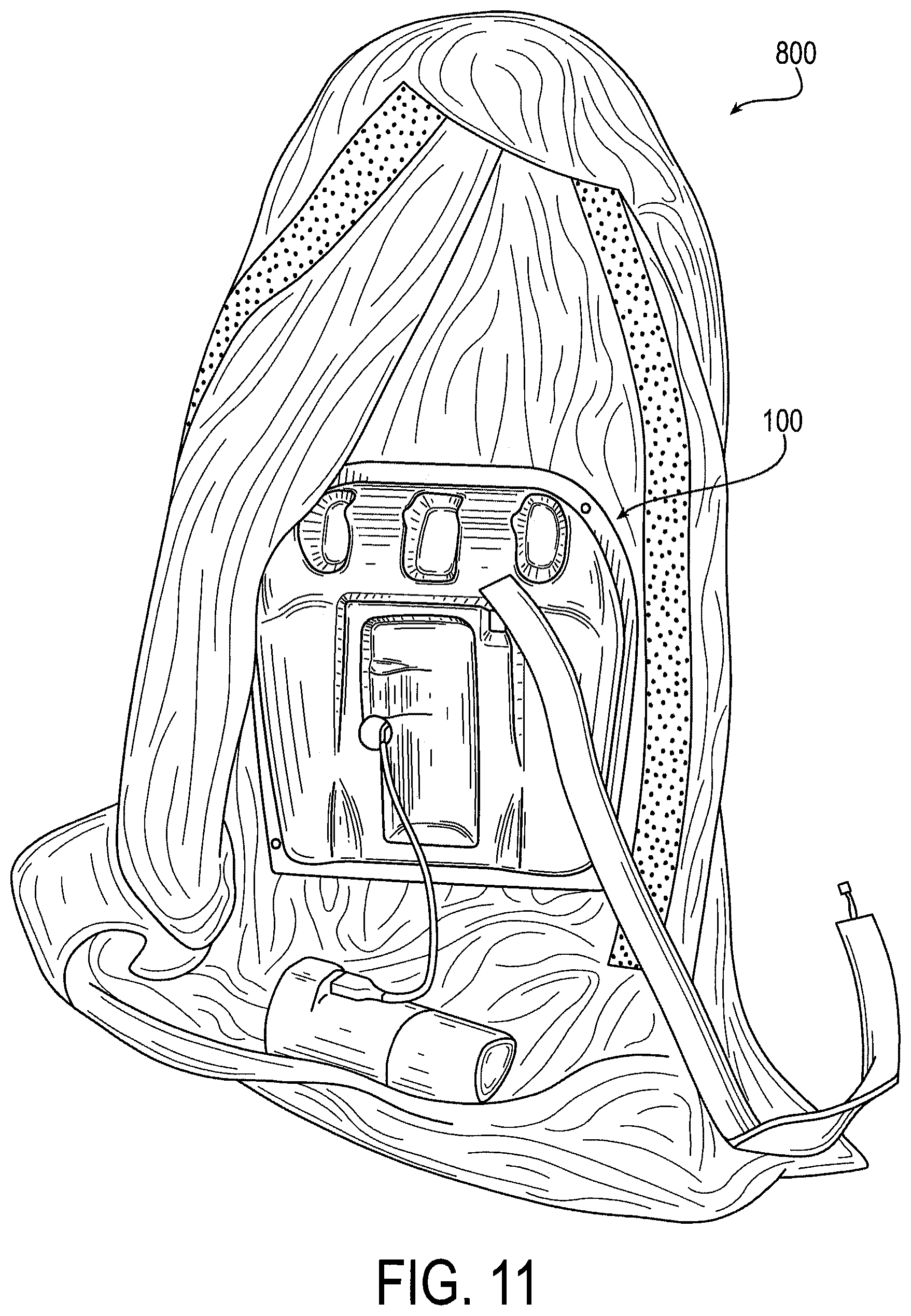 Patent US12551378 Figure 12 – Ventilation unit and controller device